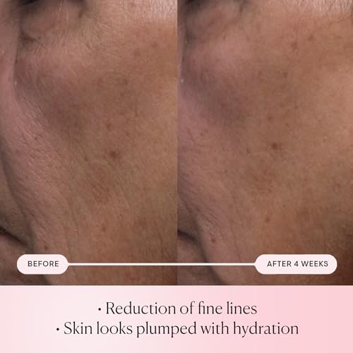 Elemis Pro-Collagen Rose Micro Serum 30ml - Anti-Aging, Fine Lines & Wrinkles Reduction