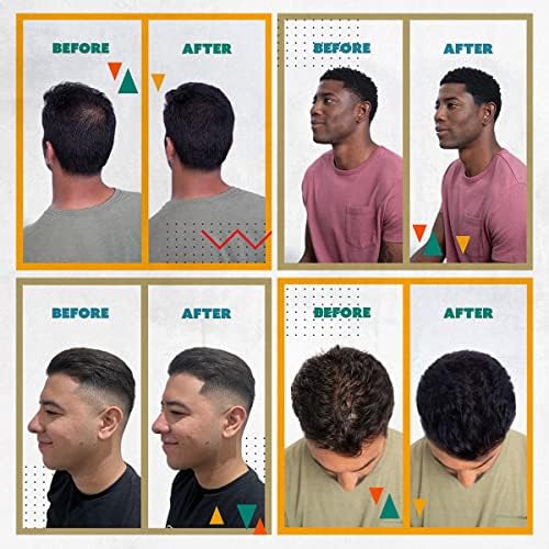 TOPPIK Spray Applicator for Precise Hair Fibre Application on Thinning Hair 6