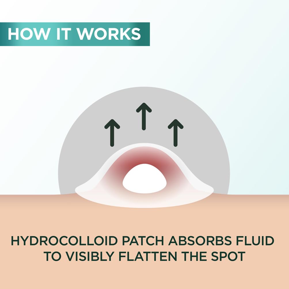 Garnier Blemish Patches: Ultra-thin Hydrocolloid Patches to Reduce Spots in 8 Hours 4