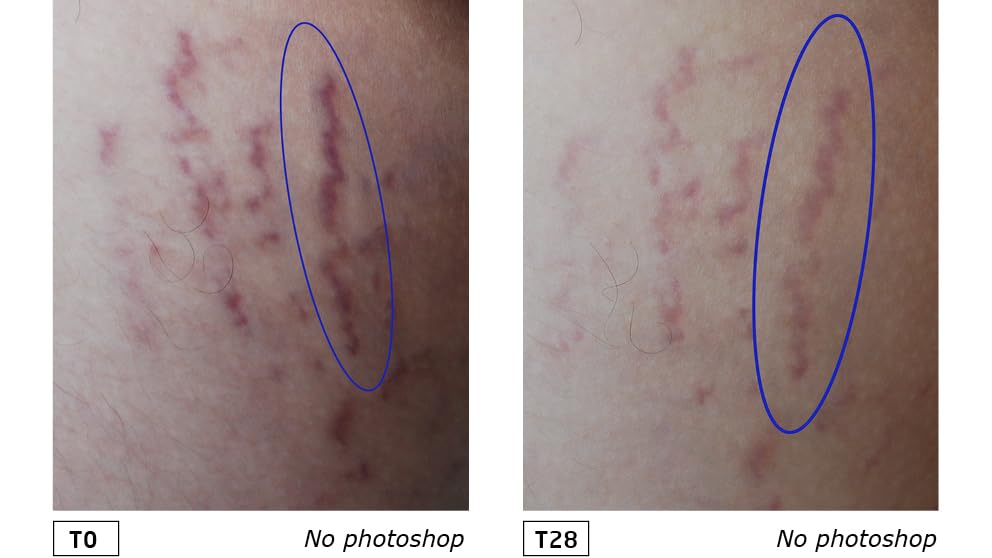 Weleda Bio-Schwangerschafts-Körperbutter für Mütter – Reichhaltige Naturkosmetik für die Körpermassage 10