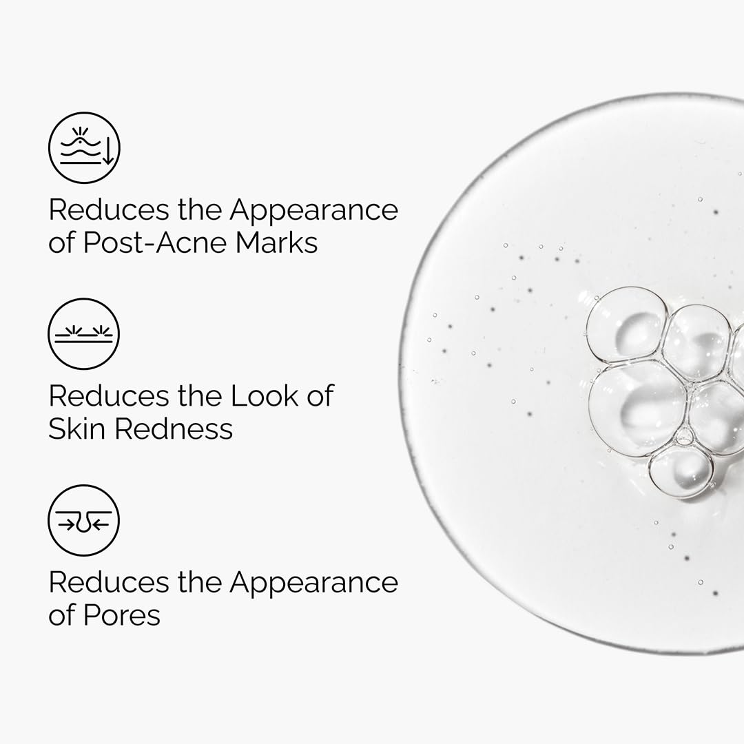 The Ordinary Aloe 2% + NAG 2% Solution for Soothing Skin and Targeting Post-Acne Marks 3