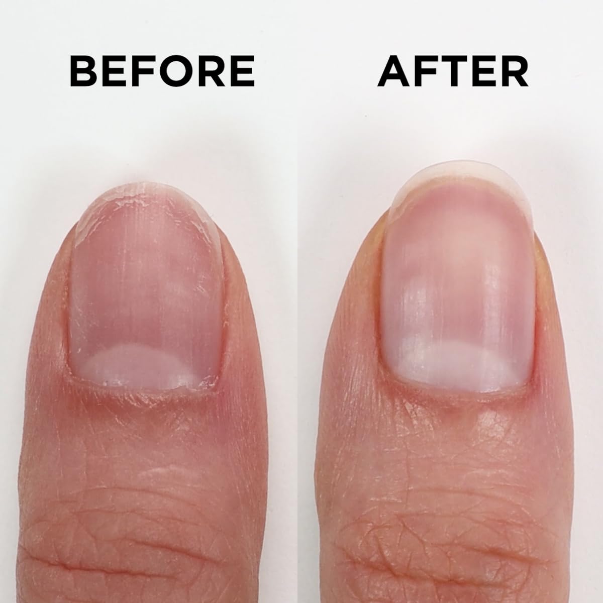 ORLY Nailtrition Nail Growth Treatment for Weak & Damaged Nails 18ml 5