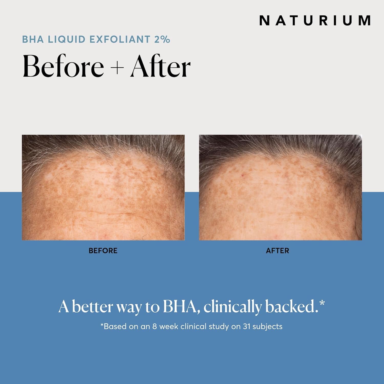 Naturium BHA Liquid Exfoliant 2% Leave-on Pore Exfoliant for Face & Skin 5