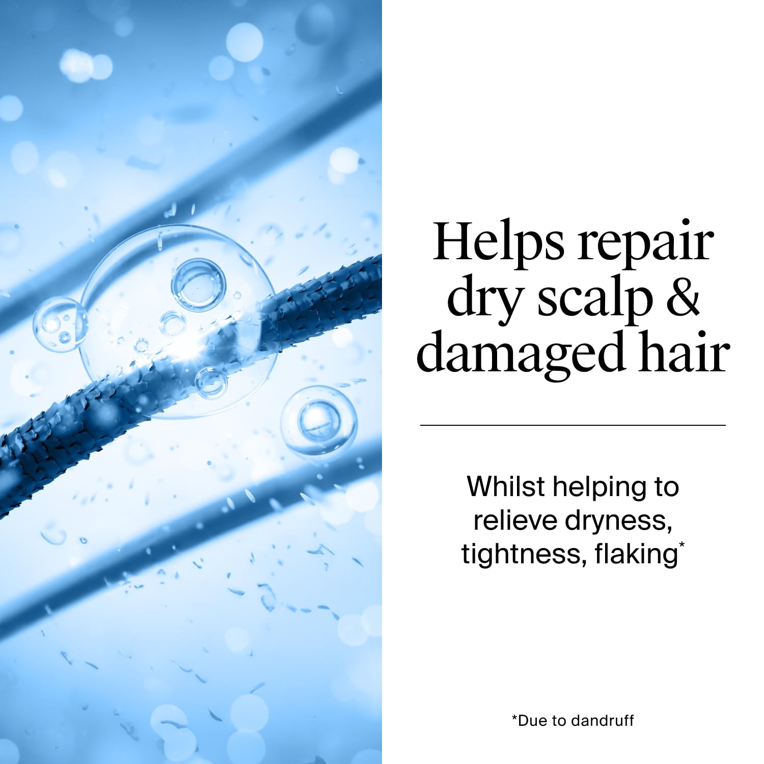 Neutrogena T/Gel Anti-Dandruff Shampoo for Dry Hair with Salicylic Acid (250ml) 4