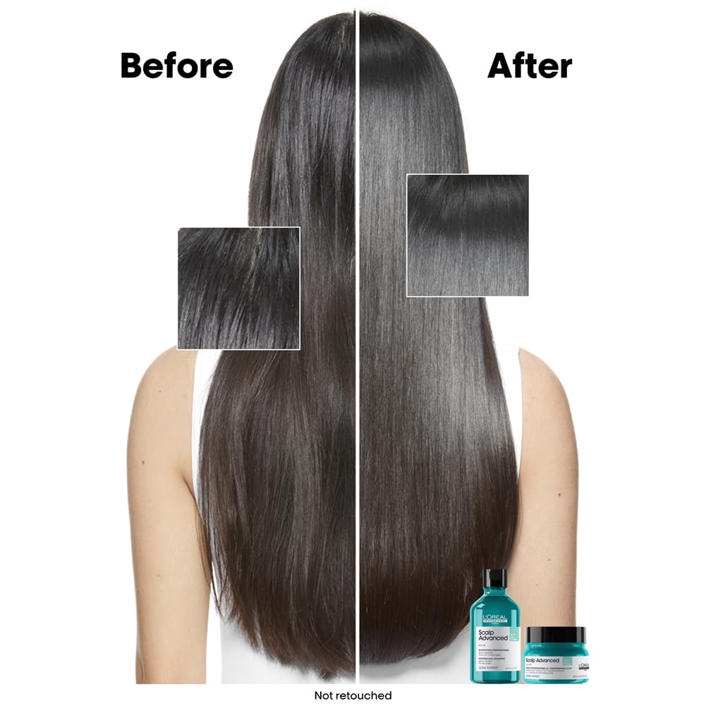L'Oréal Professionnel Scalp Advanced Professional Clay Anti-Oilness Treatment 3