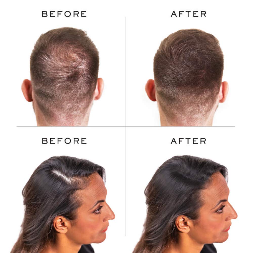 Nanogen Hair Fibres Black 15g for Instant Volume and Thickness 4