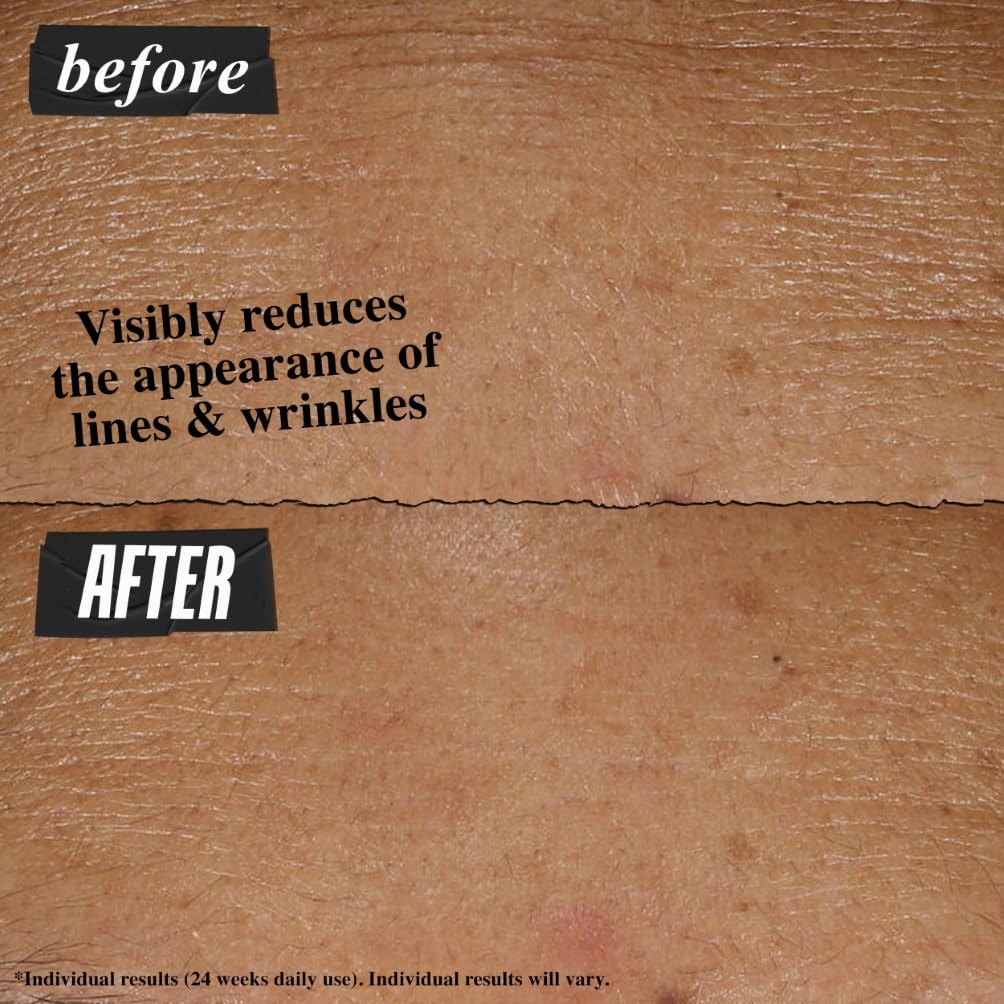 Kiehl's Retinol Skin-Renewing Daily Micro-Dose Face Serum 5