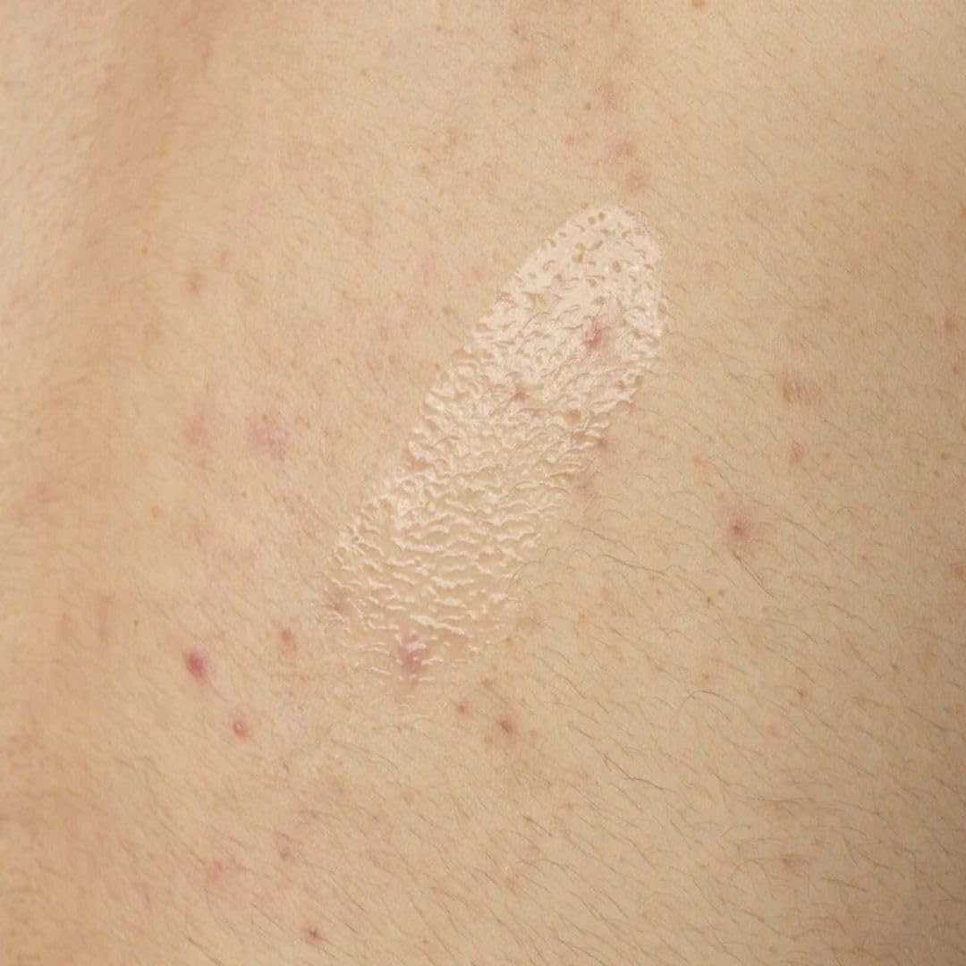 The Ordinary Salicylic Acid 0.5% Body Serum Exfoliating Treatment for Blemishes 3