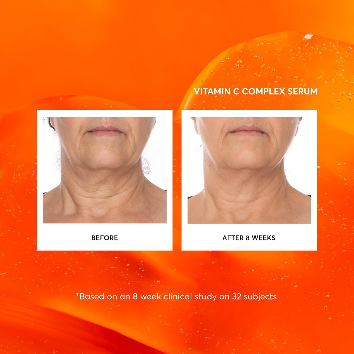 Naturium Vitamin C Complex Gesichtsserum mit Hyaluronsäure &amp; Vitamin E - Mini 4