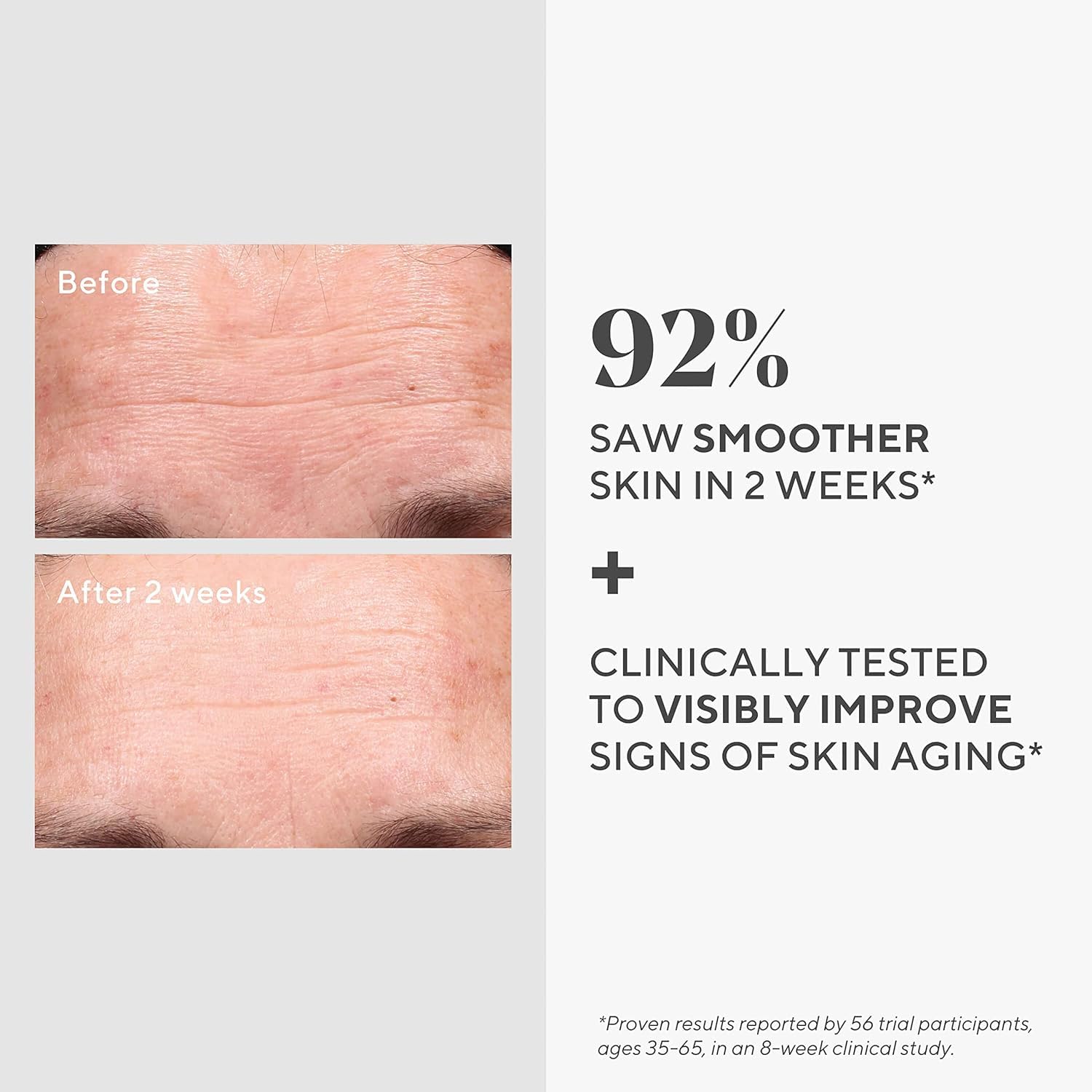 Murad Retinol Youth Renewal Serum 30ml - Fast-Acting Retinol Treatment for Face 3