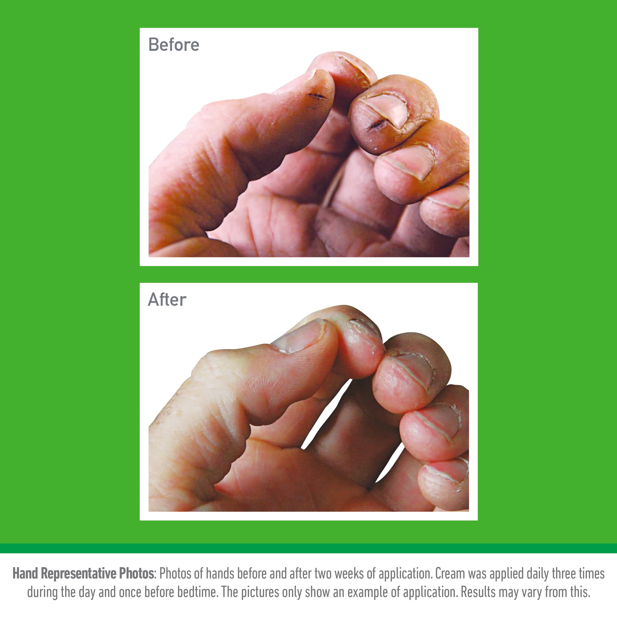 O'Keeffe's Working Hands Hand Cream (2 Pack, 80ml) for Extremely Dry, Cracked Hands 3