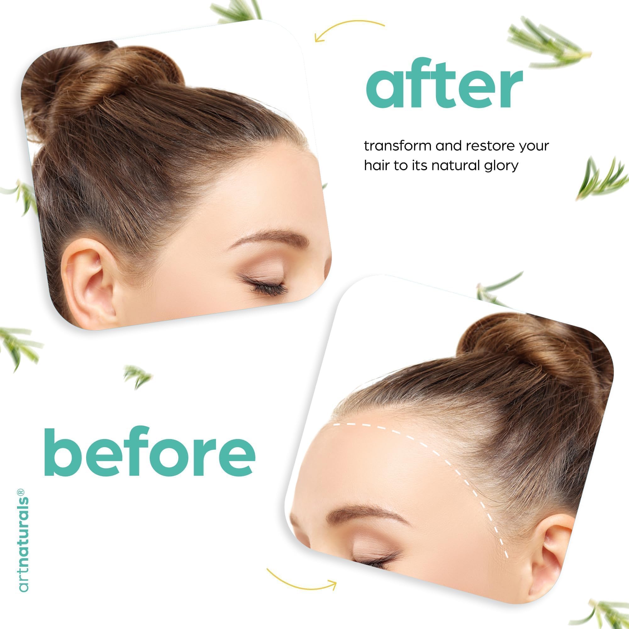 Artnaturals Bio-Rosmarin-Rizinus-Haaröl + Kopfhautmassagegerät 118 ml 6