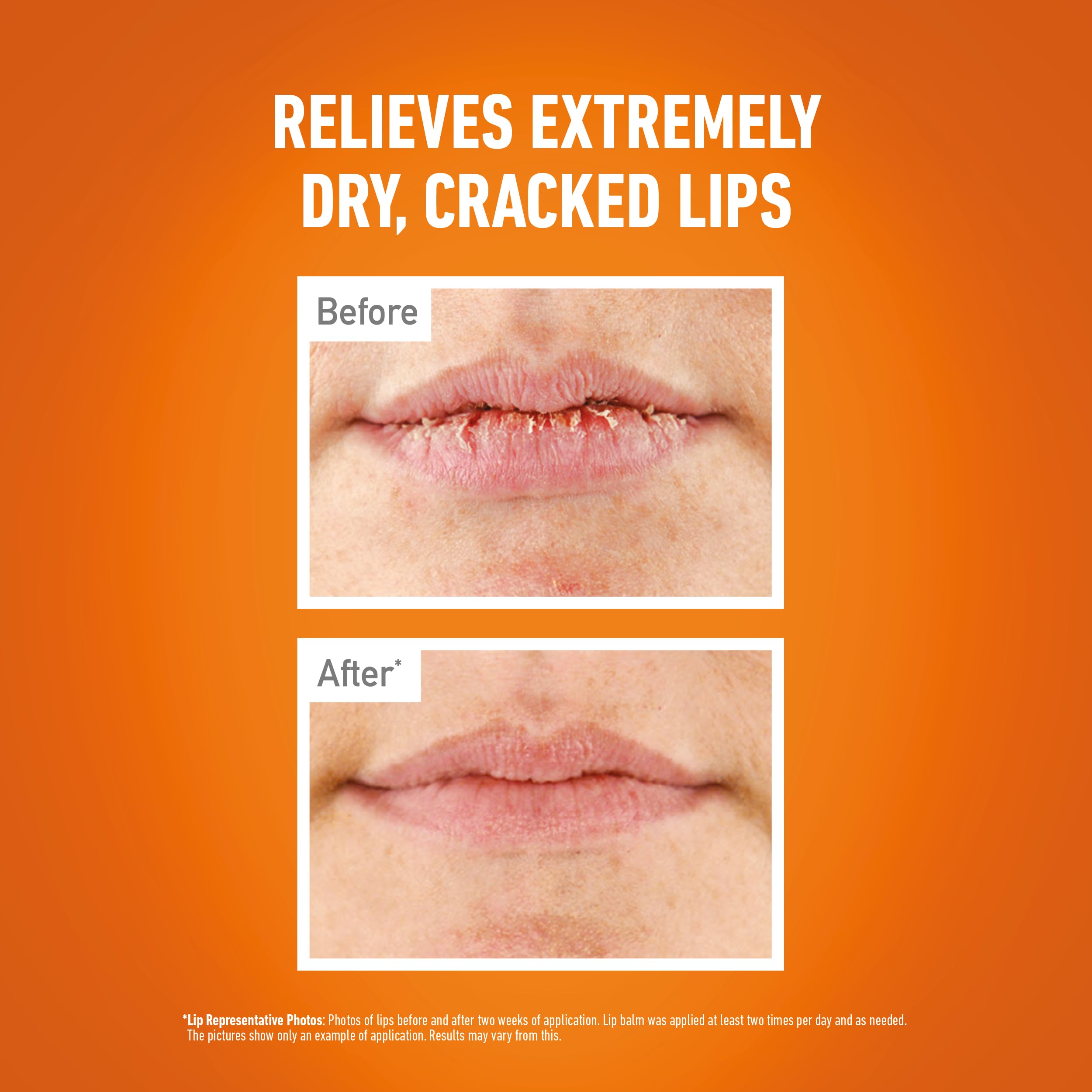 O'Keeffe's Lip Repair and Protect with SPF 15 for Extremely Dry Lips 4.2g 6