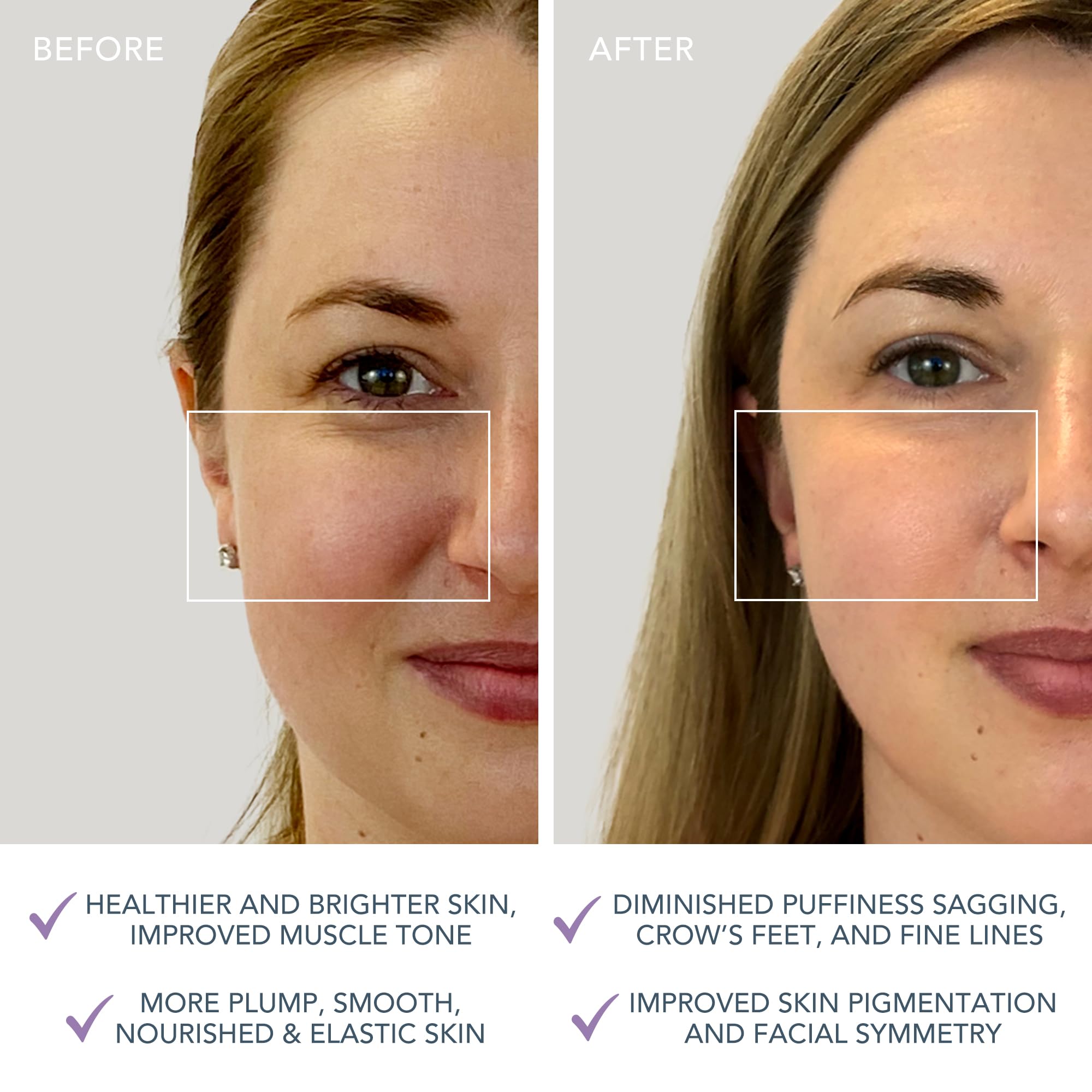 FOREO Bear Mini Targeted Microcurrent Face Lifting & Toning Device 5