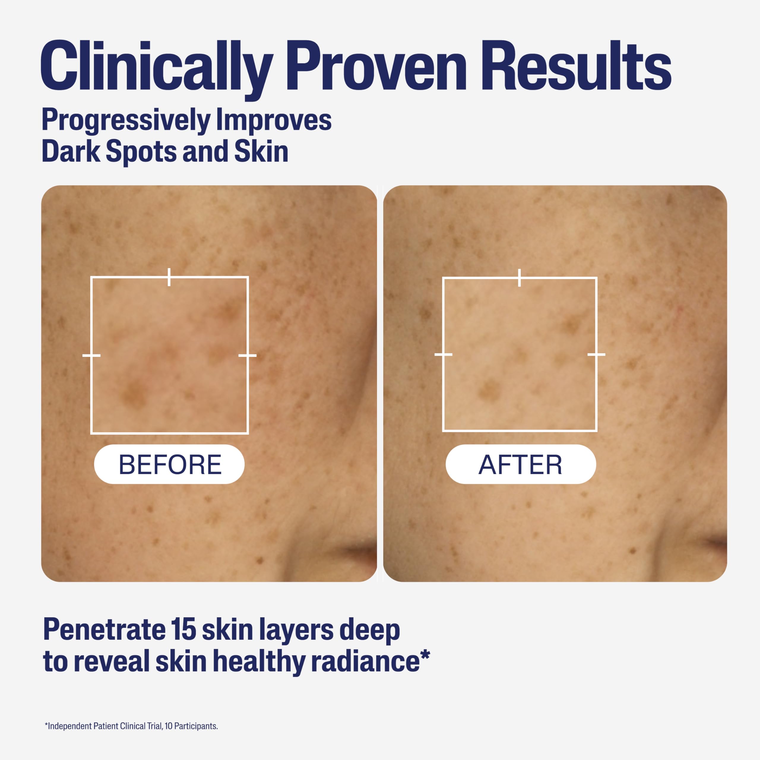 Cetaphil Healthy Radiance Brightening Serum with Niacinamide for Dark Spots 5