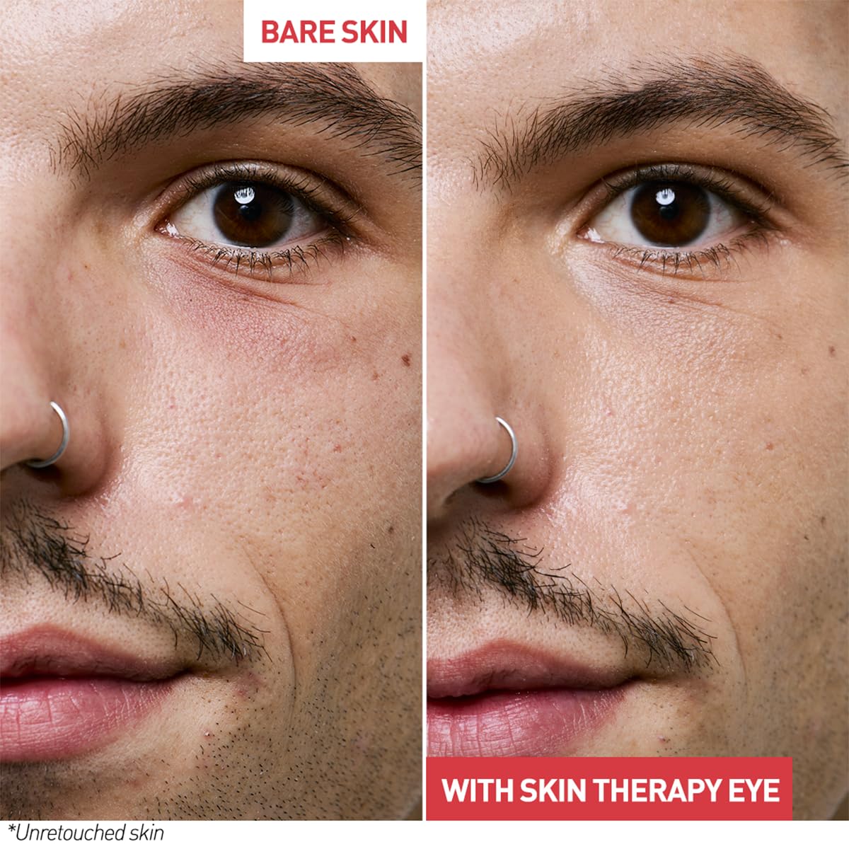 Erborian Skin Therapy Eye Multi-Perfecting Eye Cream with 9 Super Ingredients 4