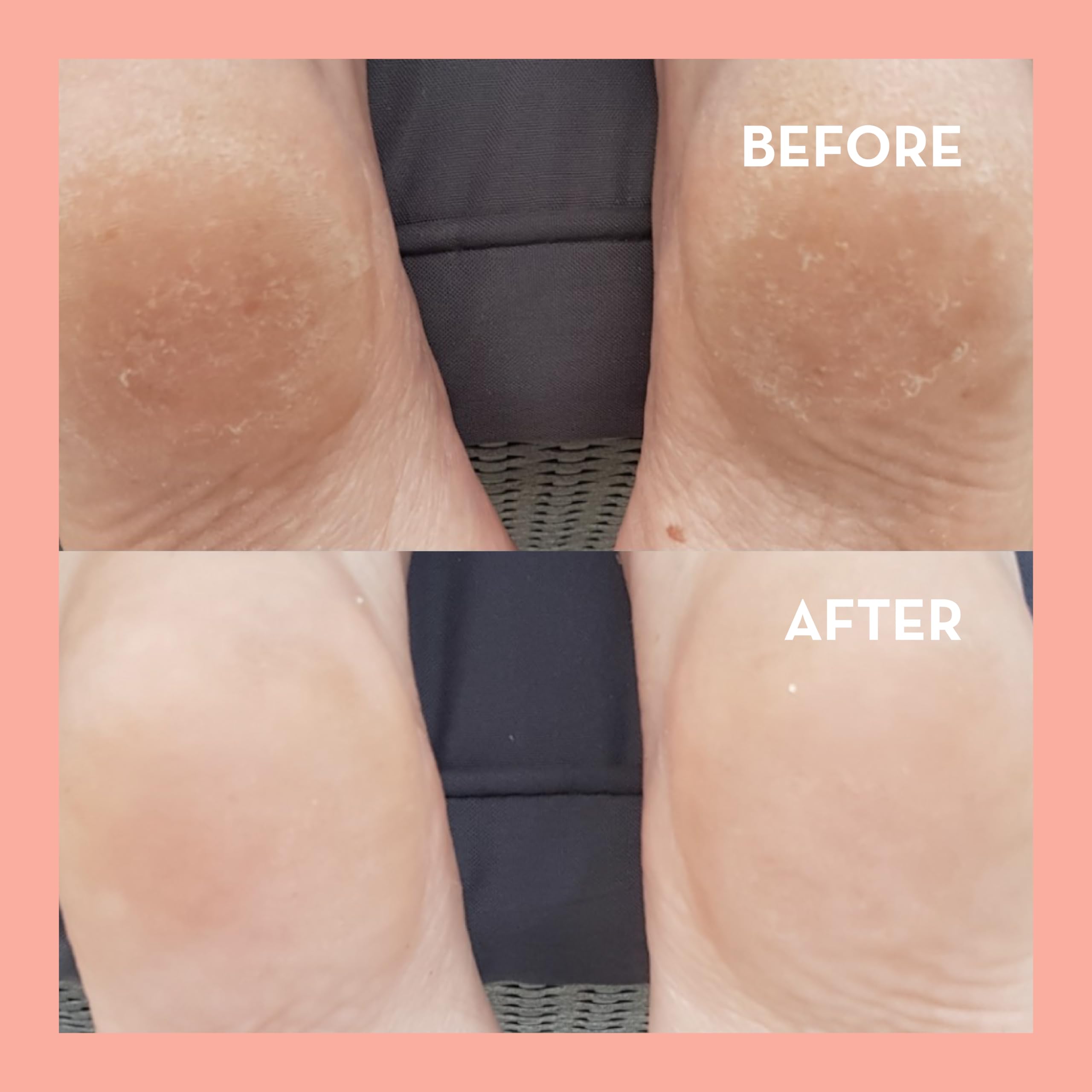 Seoulista Beauty Rosy Toes Sofort-Pediküre – Fußmaskenbehandlung für zu Hause — 3
