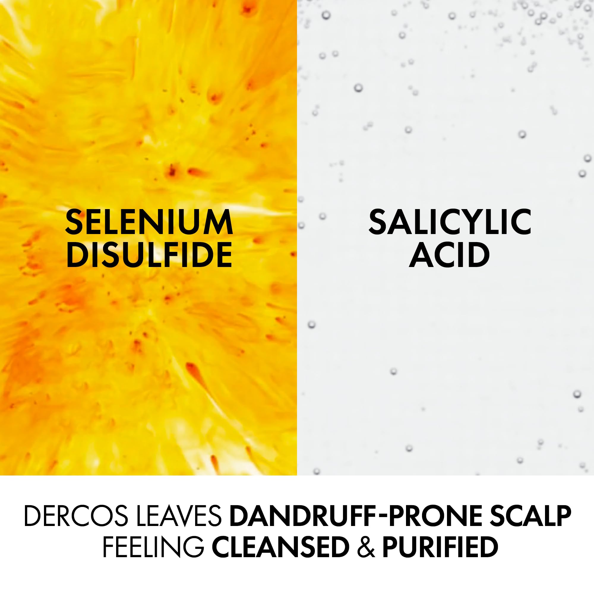 Vichy Dercos Anti-Schuppen- und Anti-Juckreiz-Shampoo für normales bis fettiges Haar 20 5