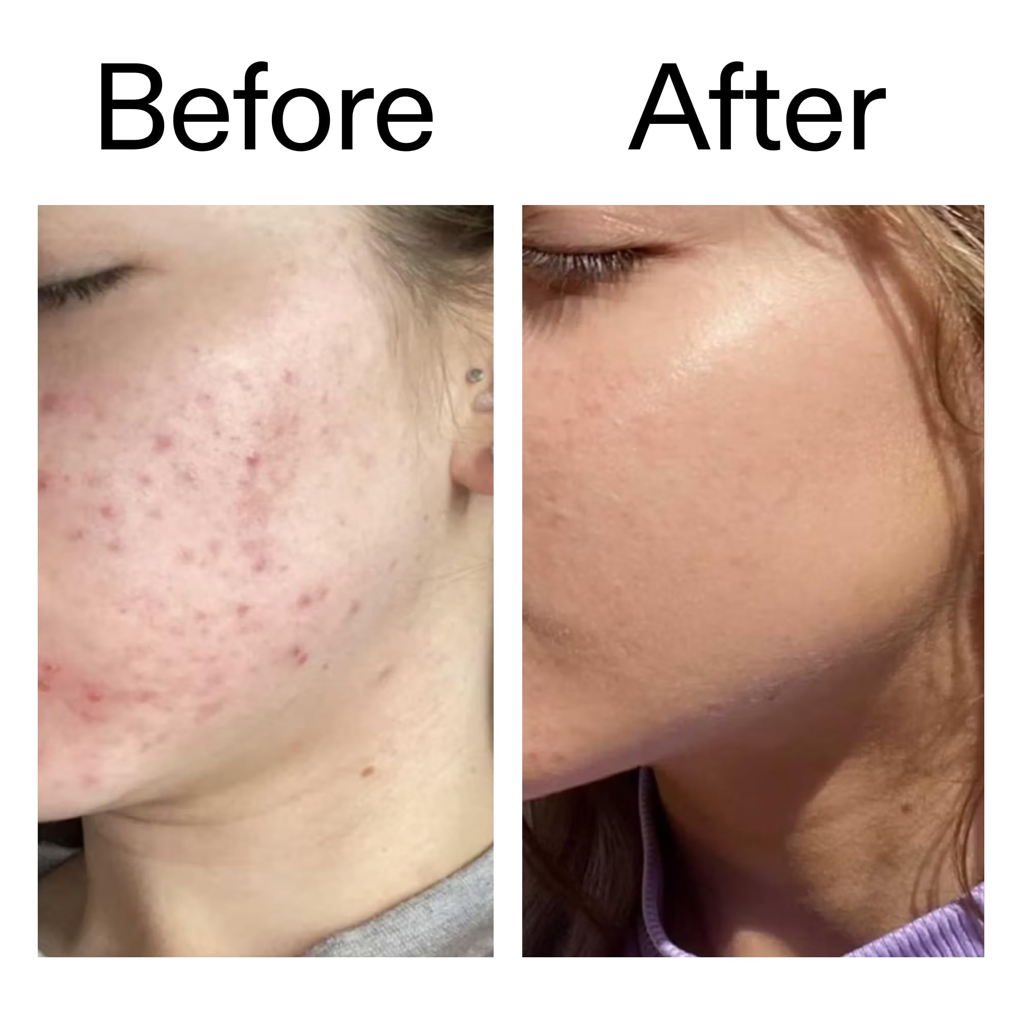 The INKEY List Beta Hydroxy Acid Serum with 2% Salicylic Acid and 1% Hyaluronic Acid 6