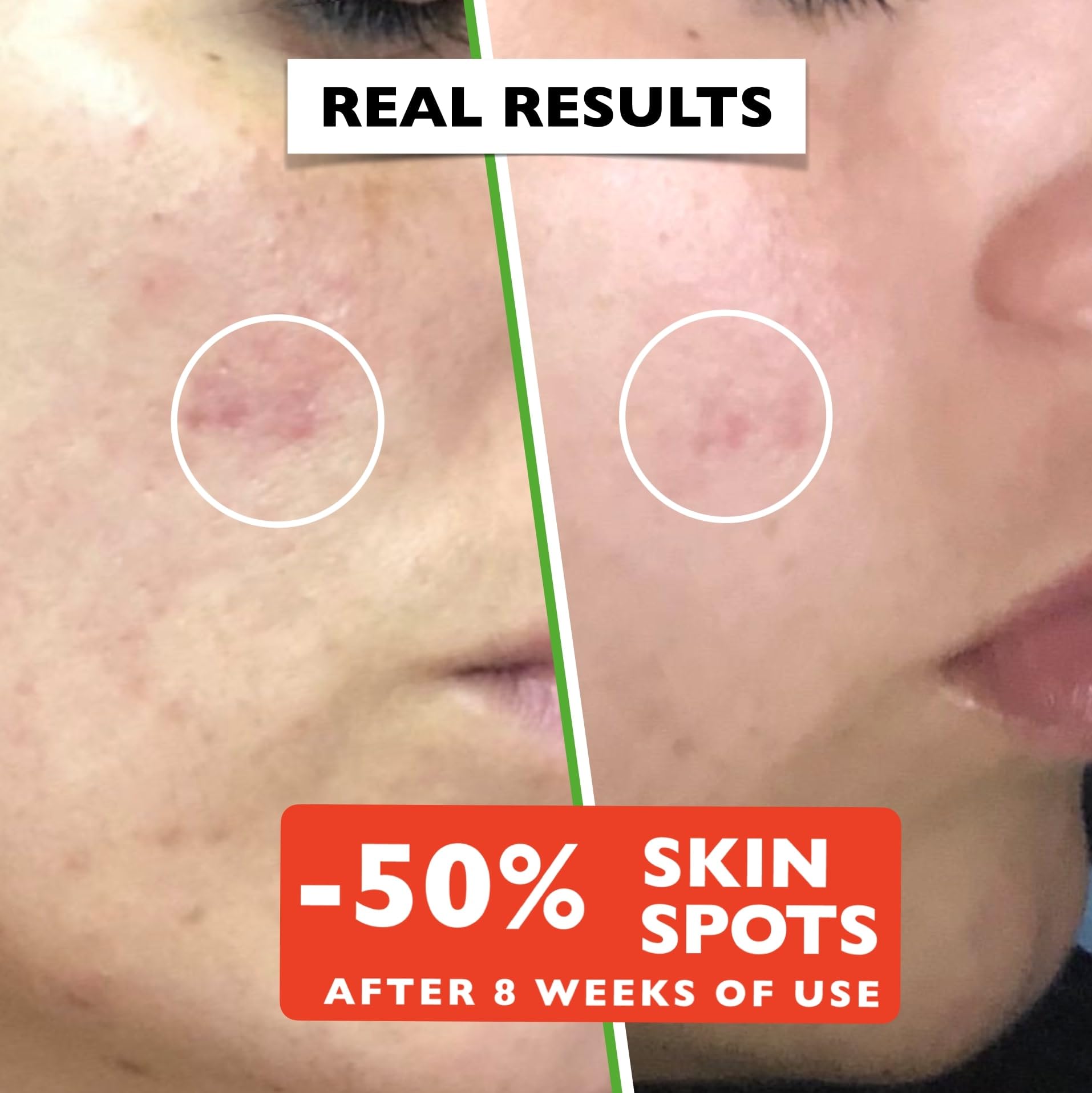 Lanadore Advanced Organic Vitamin C Serum with Hyaluronic Acid for Face & Eye Contour (2.11oz) 4