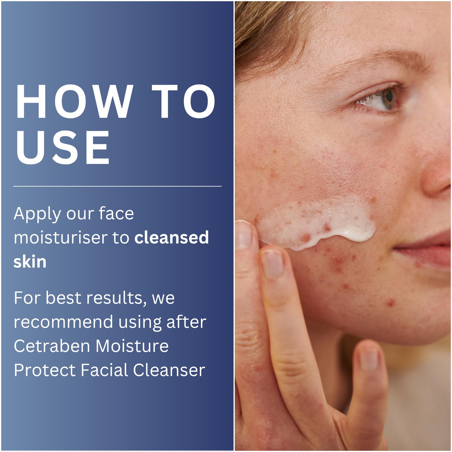 Cetraben Nourishing Facial Night Cream for Dry, Itchy & Eczema-Prone Skin 4