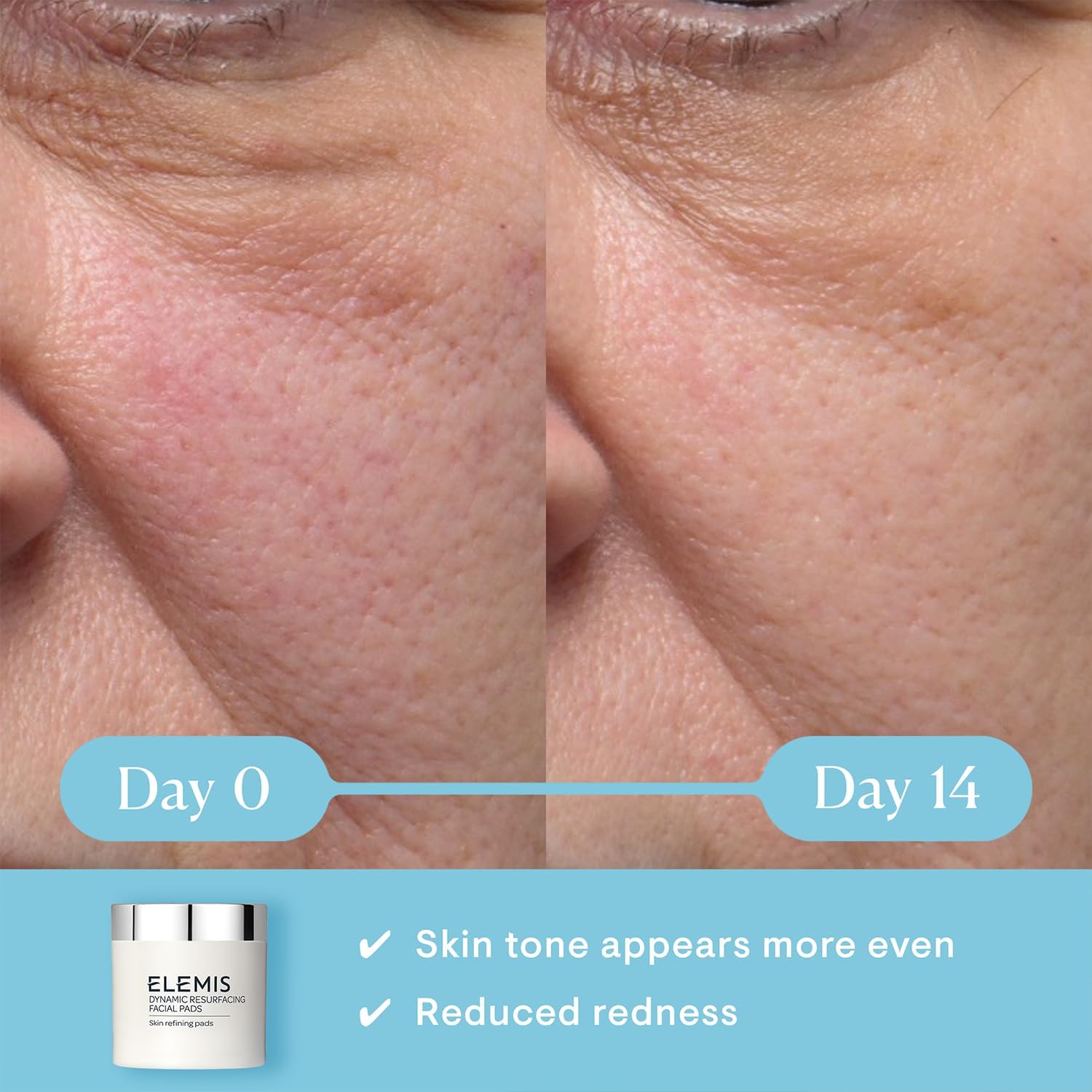 ELEMIS Dynamic Resurfacing Gesichtspads (60er-Packung) – Sanftes Peeling, rund 3
