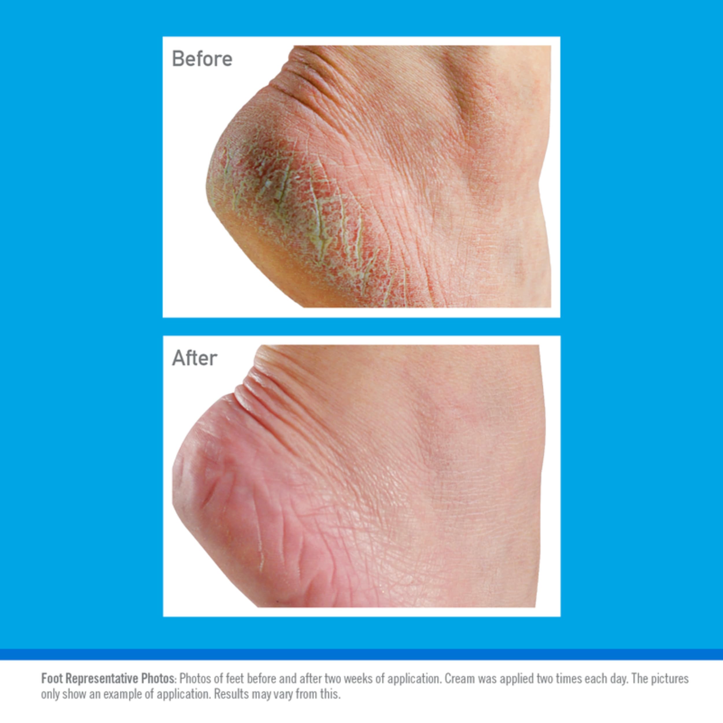 O'Keeffe's Healthy Feet Foot Cream (91g Tub) 3