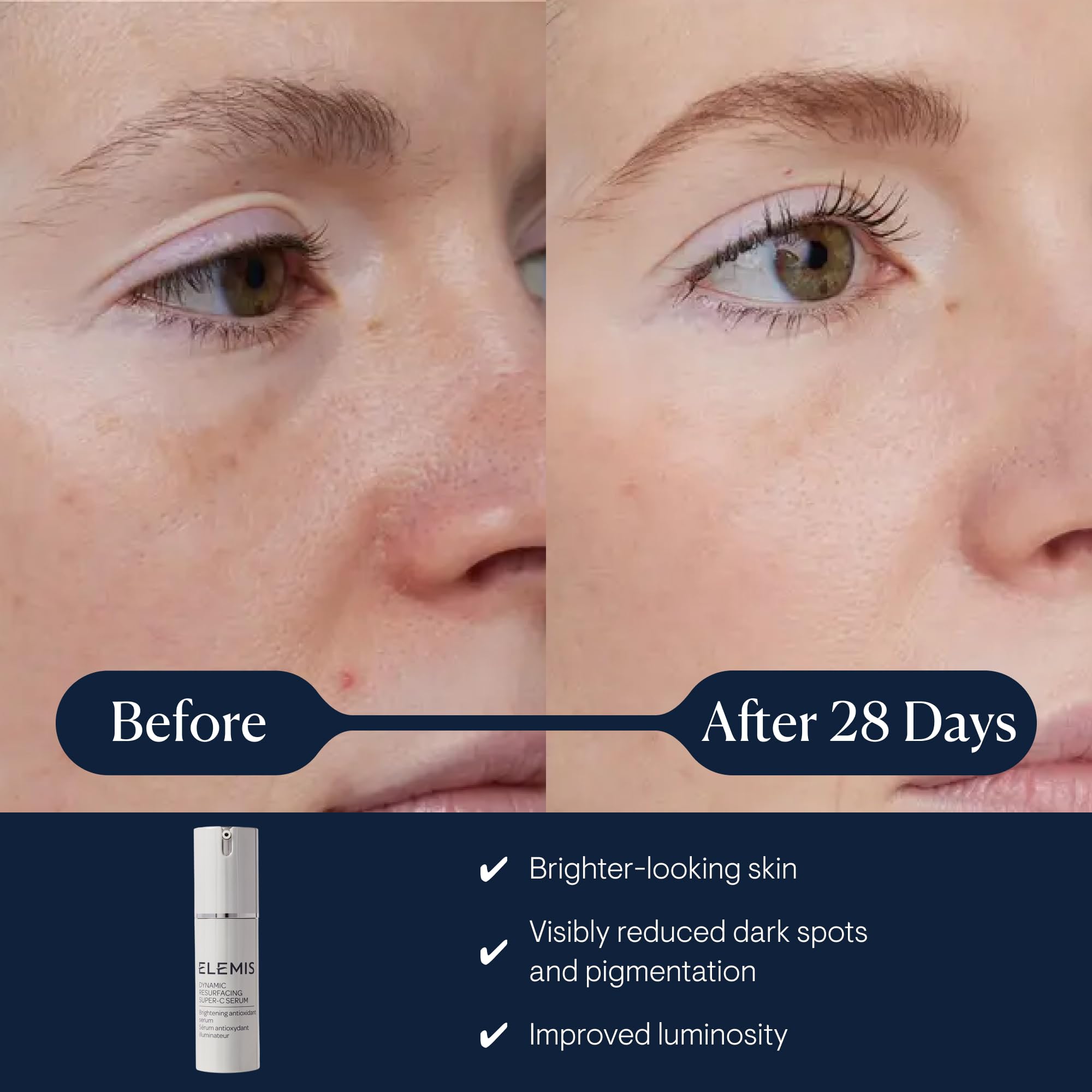 Elemis Dynamic Resurfacing Super-C Serum, Brightening Antioxidant Vitamin C, 30ml