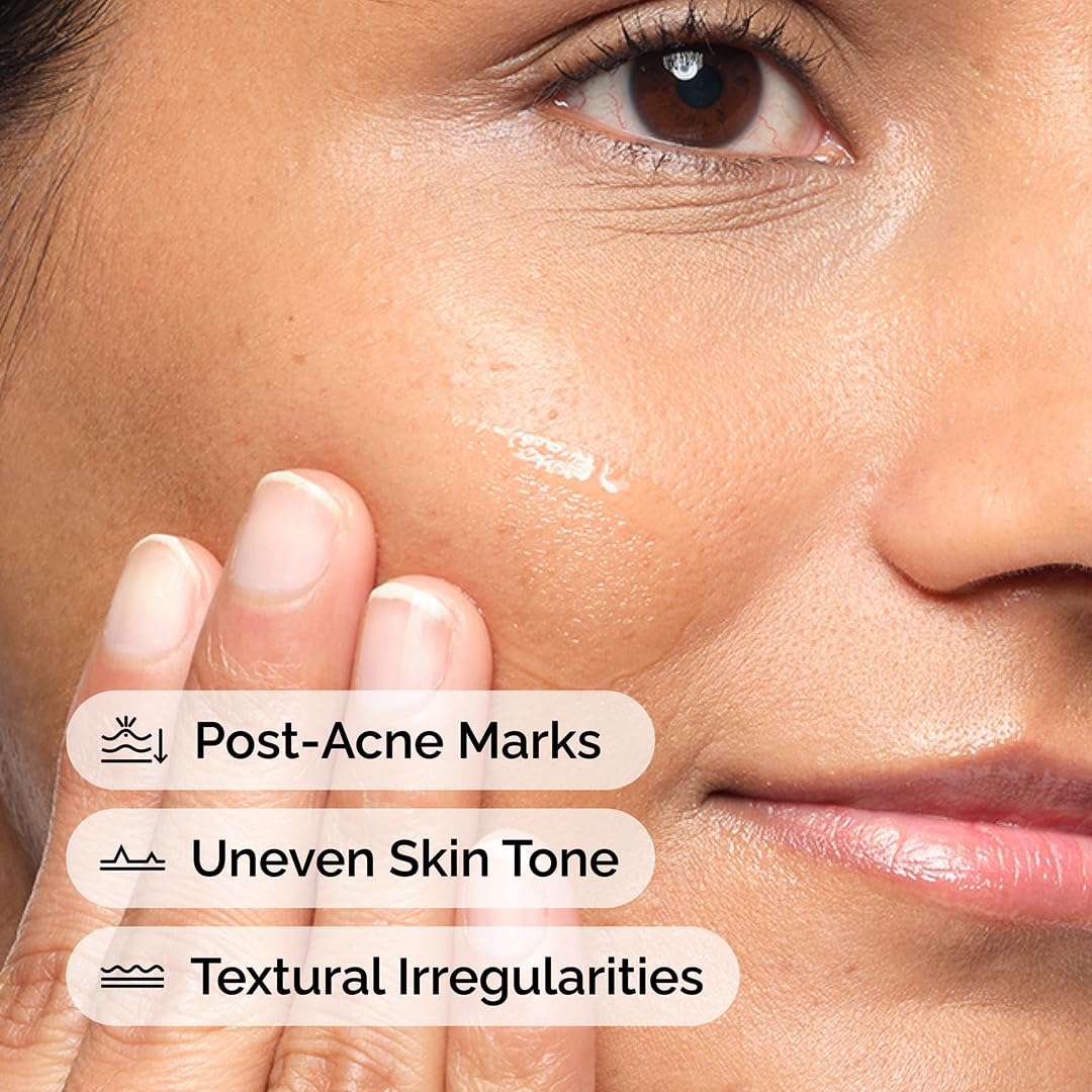 The Ordinary Aloe 2% + NAG 2% Solution for Soothing Skin and Targeting Post-Acne Marks 4