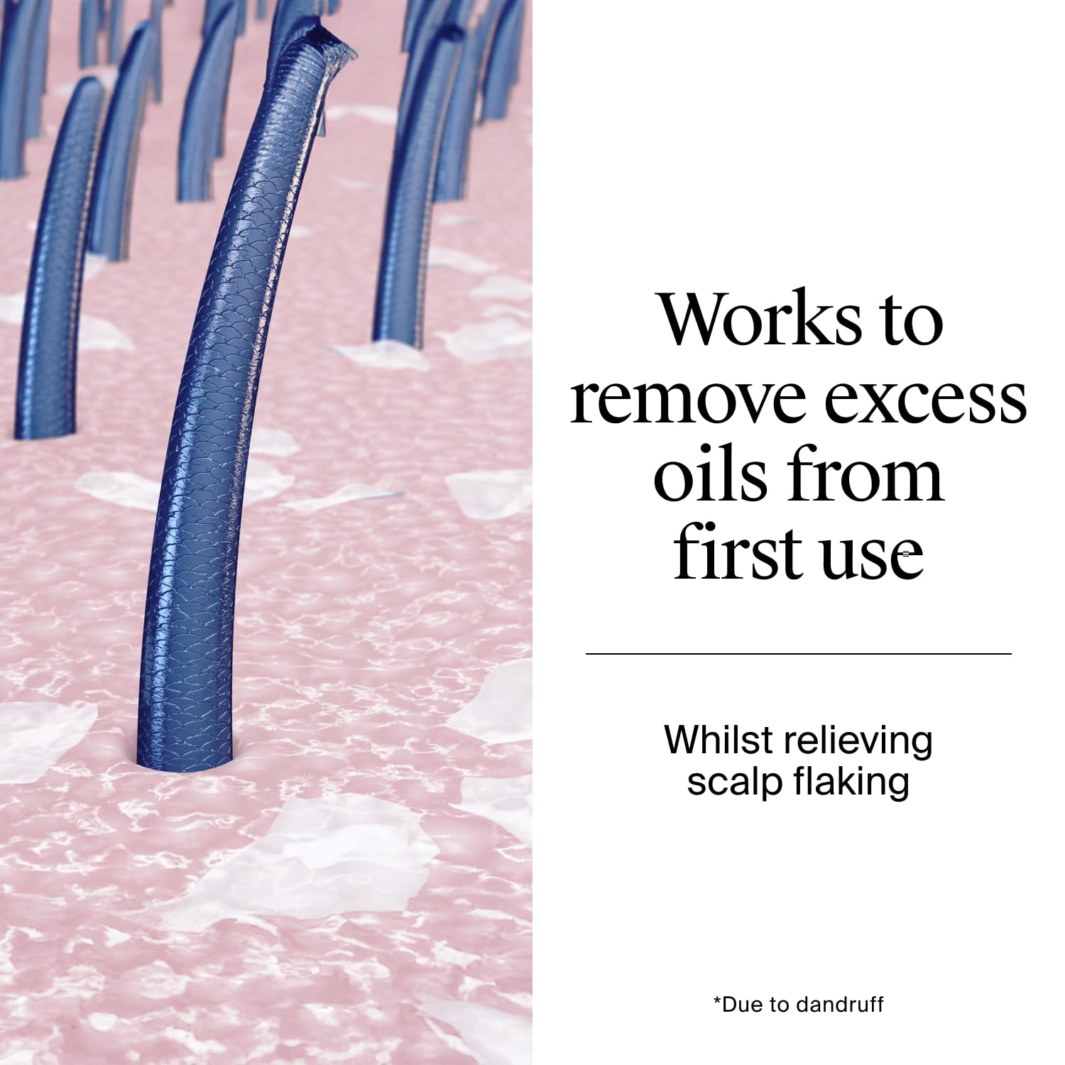 Neutrogena T/Gel Anti-Dandruff Shampoo for Oily Scalp and Hair 250ml 5