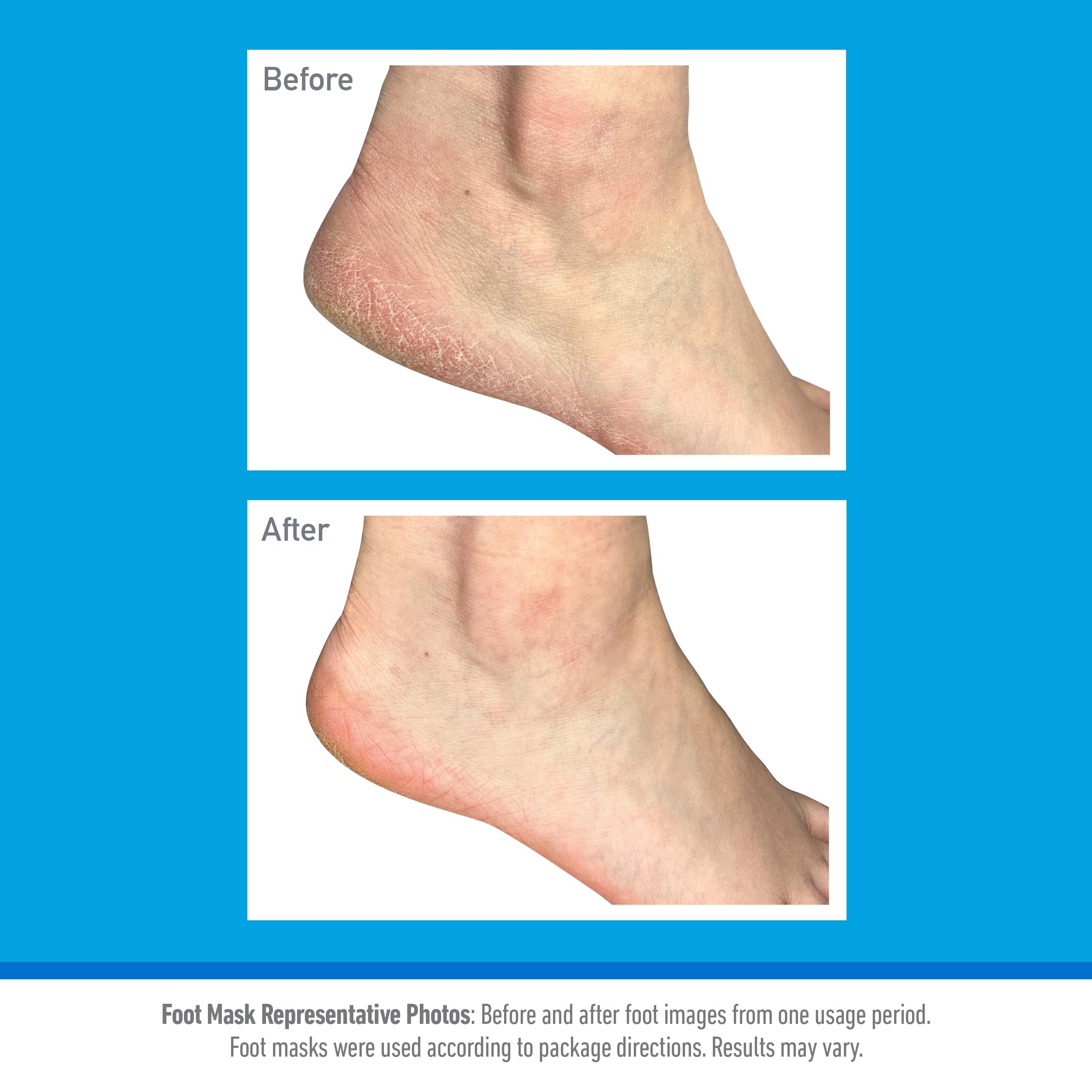 O’Keeffe’s Healthy Feet Intensive Moisturising Foot Mask for Dry, Rough Feet 4