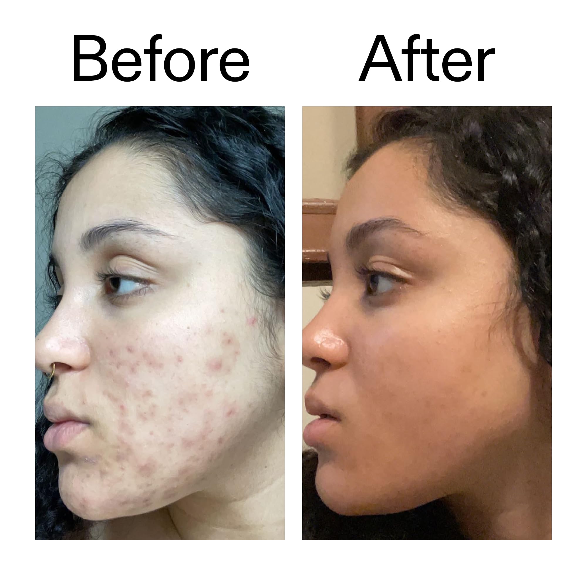 The Inkey List 2% Tranexamic Acid Serum for Dark Spots and Complexion Brightening (30ml) 6