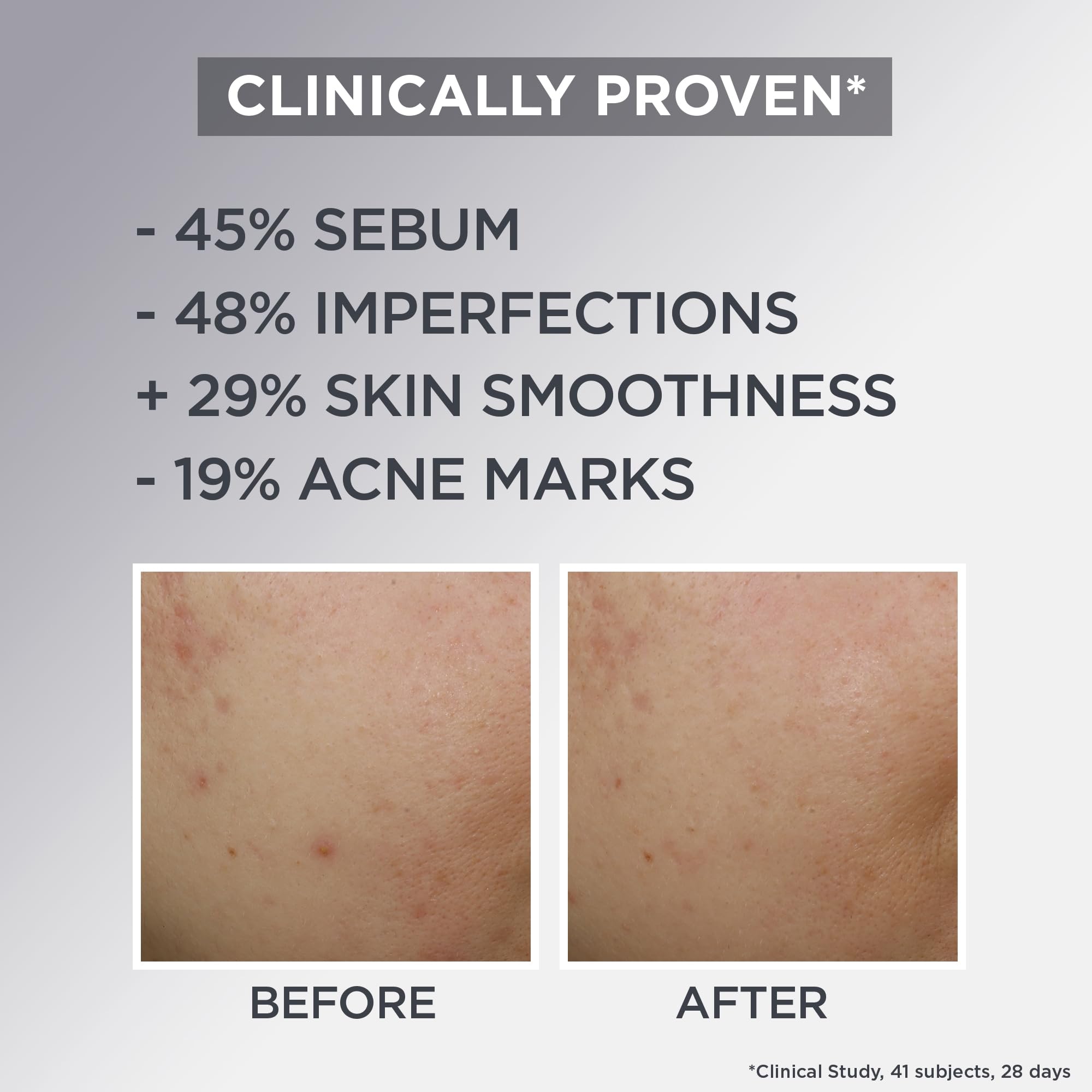 Garnier Pure Active AHA+BHA Charcoal Daily Mattifying Air Cream for Oil Control 9