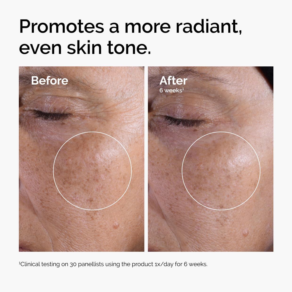 The Ordinary Glycolic Acid 7% Exfoliating Toner for Brightening and Smoothing