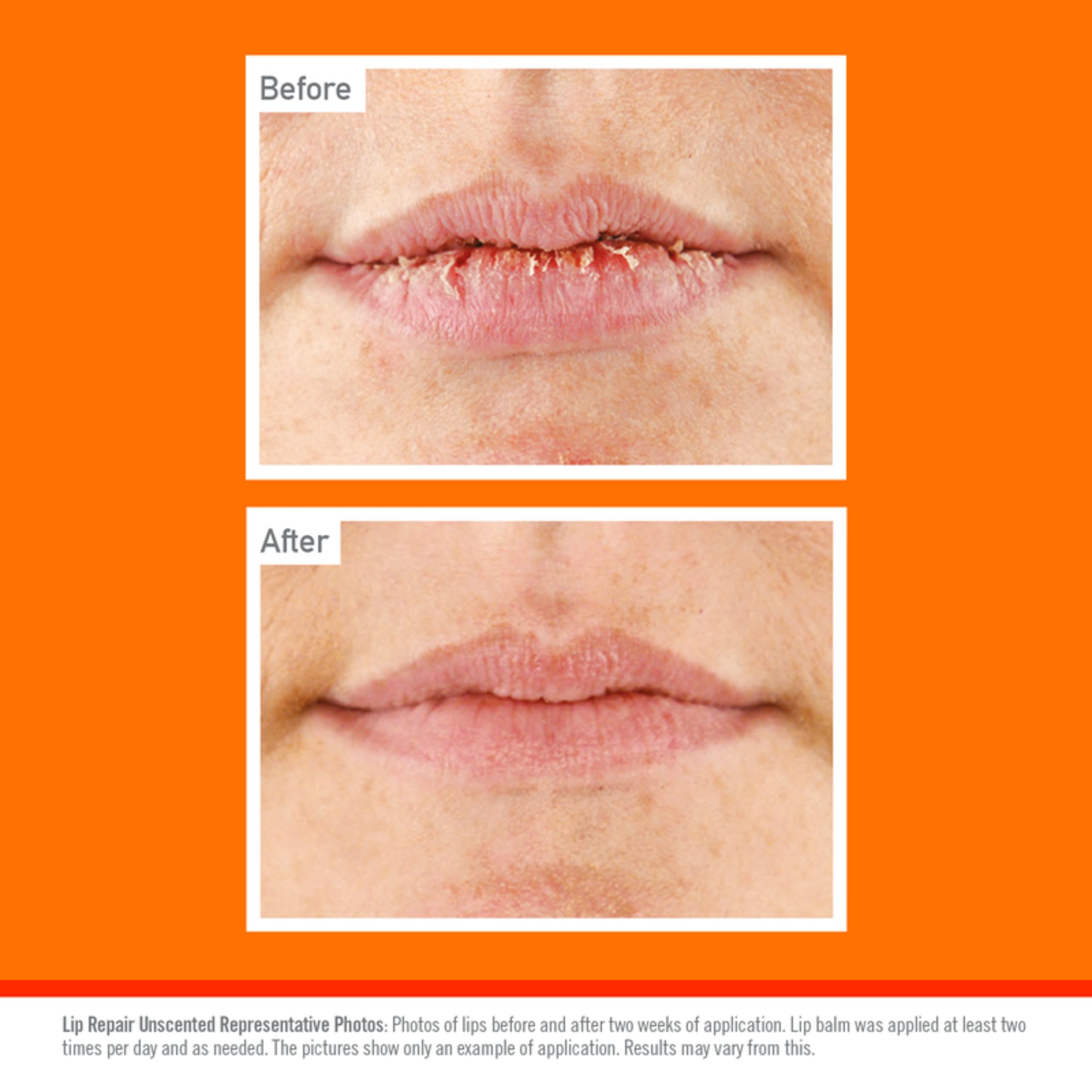 O'Keeffe's Lip Repair Unscented Lip Balm for Extremely Dry, Cracked Lips, 4.2g 6