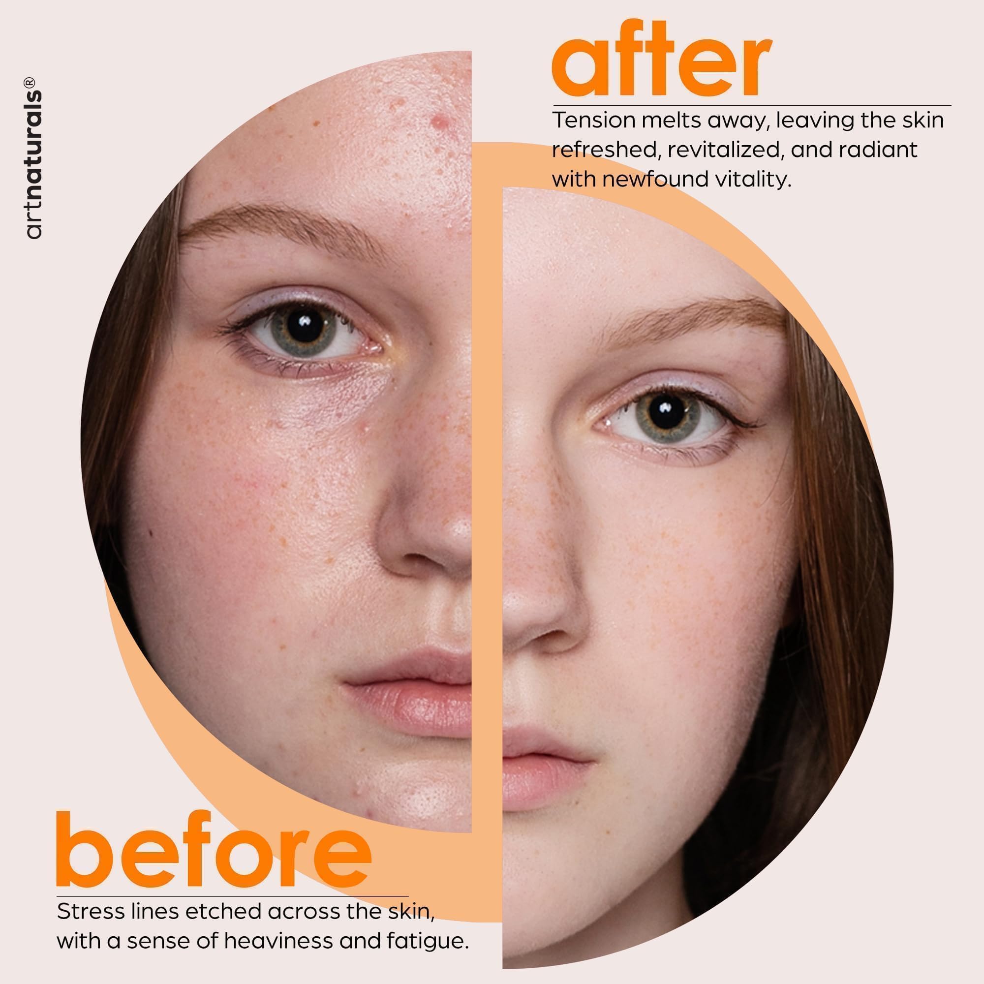 Artnaturals Vitamin E Bio Oil (4.0oz) & Gua Sha Facial Tools Set for Body and Face 5