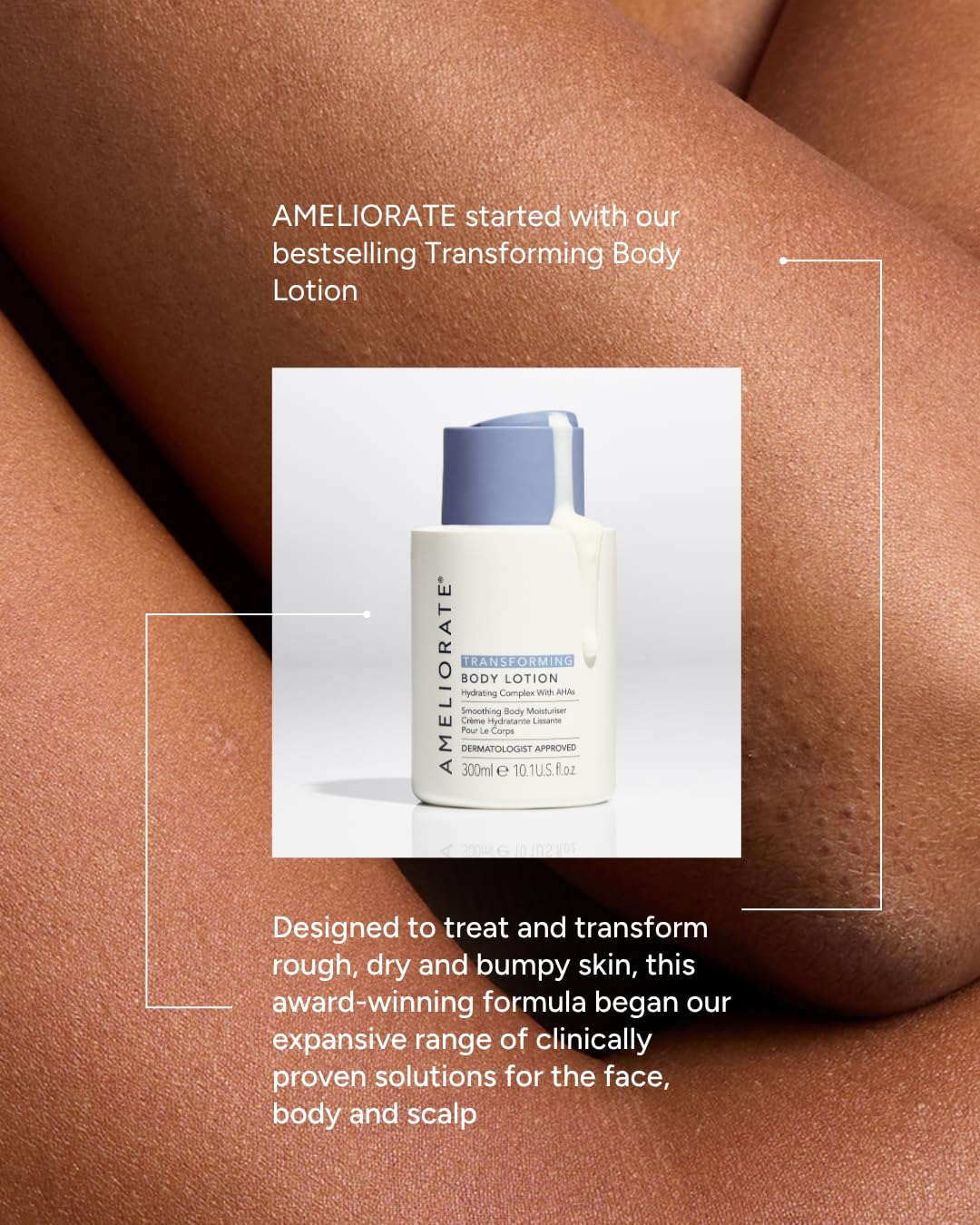 AMELIORATE Transforming Body Lotion 300ml with Lactic Acid for KP, Bumpy Skin & Ingrown Hairs