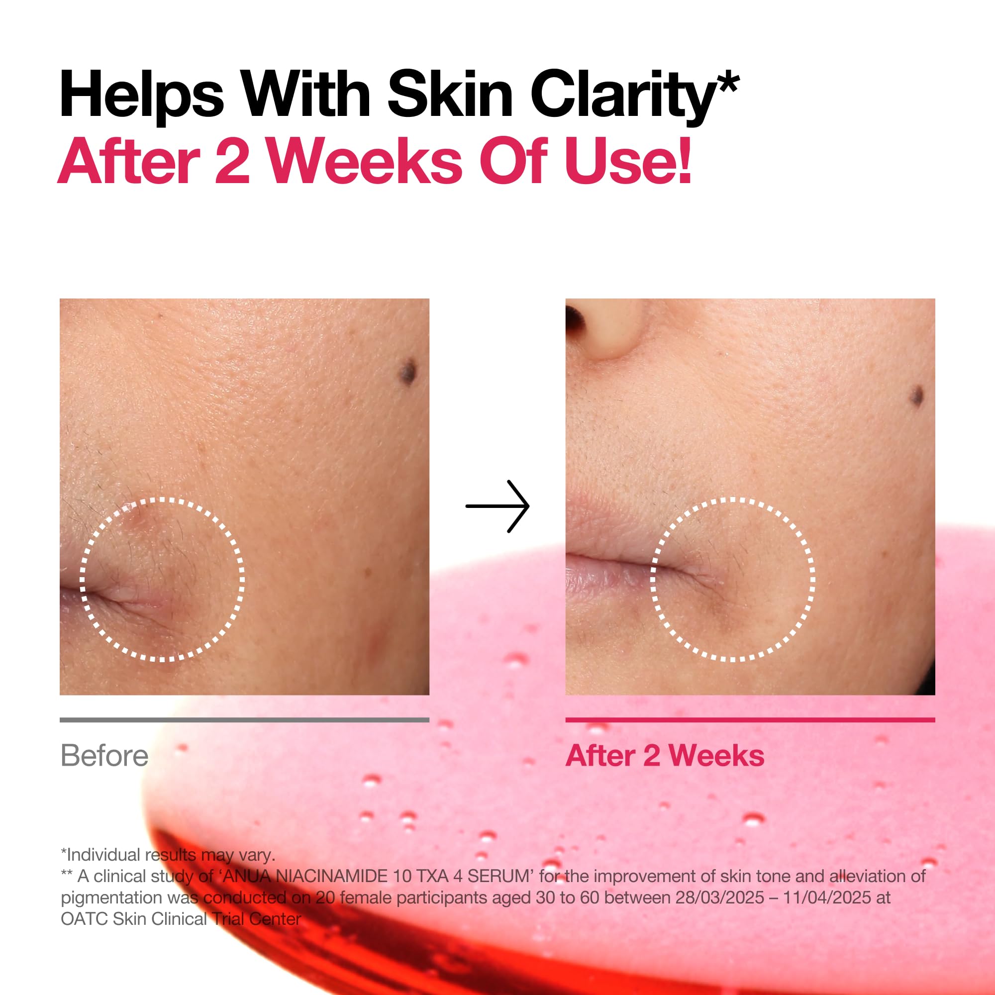 ANUA 10% Niacinamide + 4% TXA Serum with Ceramide and Hyaluronic Acid 6