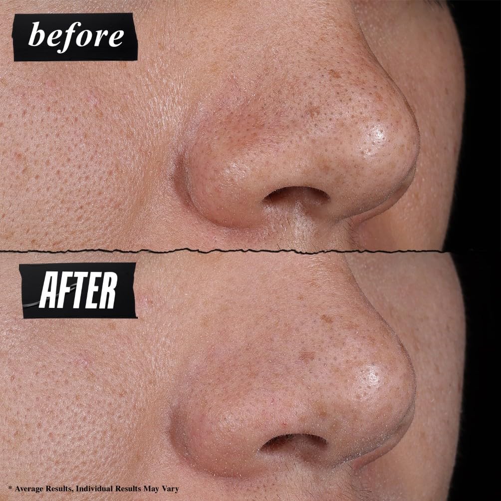 Kiehl's Rare Earth Pore-Minimizing Clay Mask for Purifying and Minimizing Pores 7