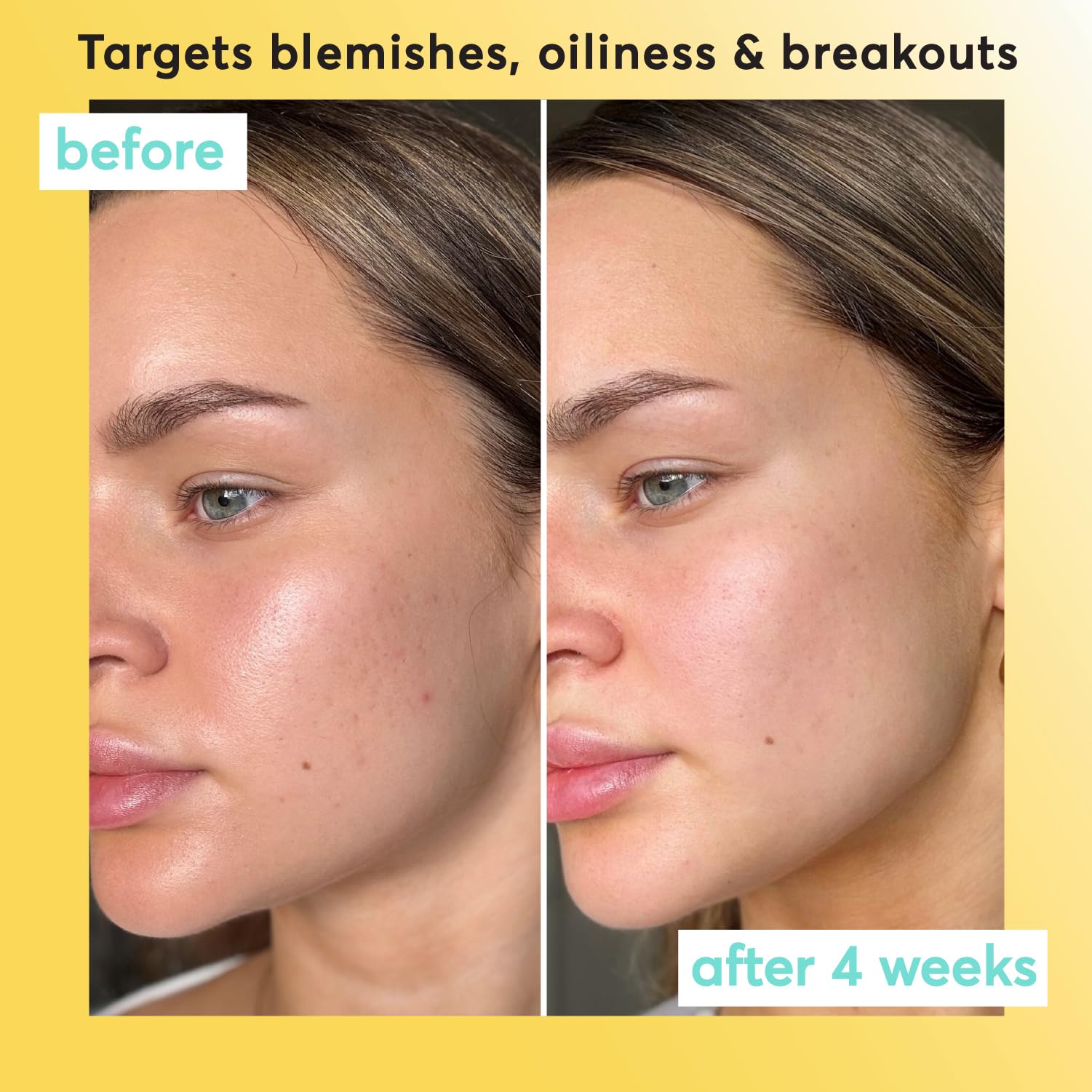Super Facialist Clear Skin Pore Clarity Daily Exfoliator 150ml with Niacinamide & Tea Tree Oil 4