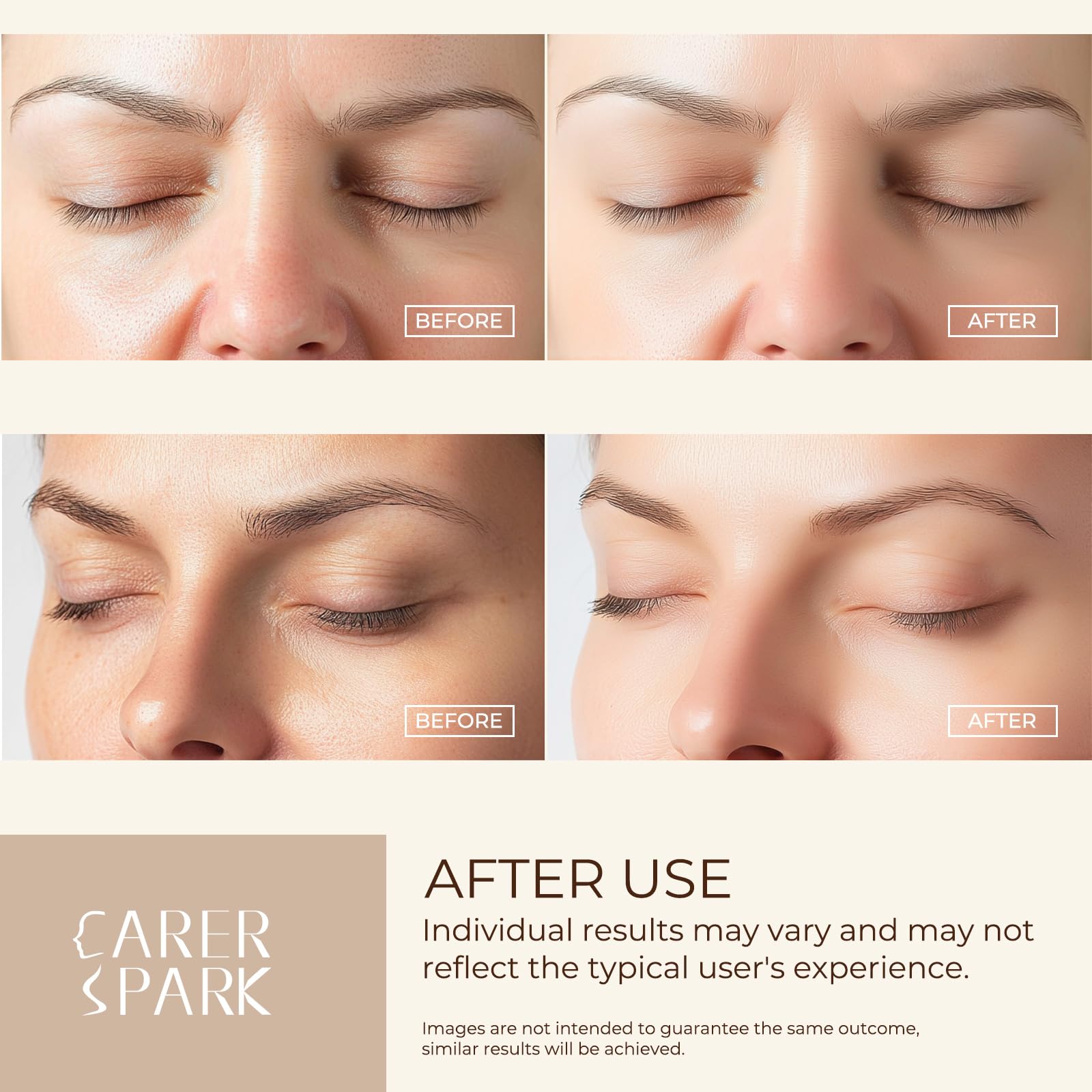 CARER SPARK Ultrasonic Facial Scrubber with EMS Microcurrent and Red/Blue Light Therapy 5