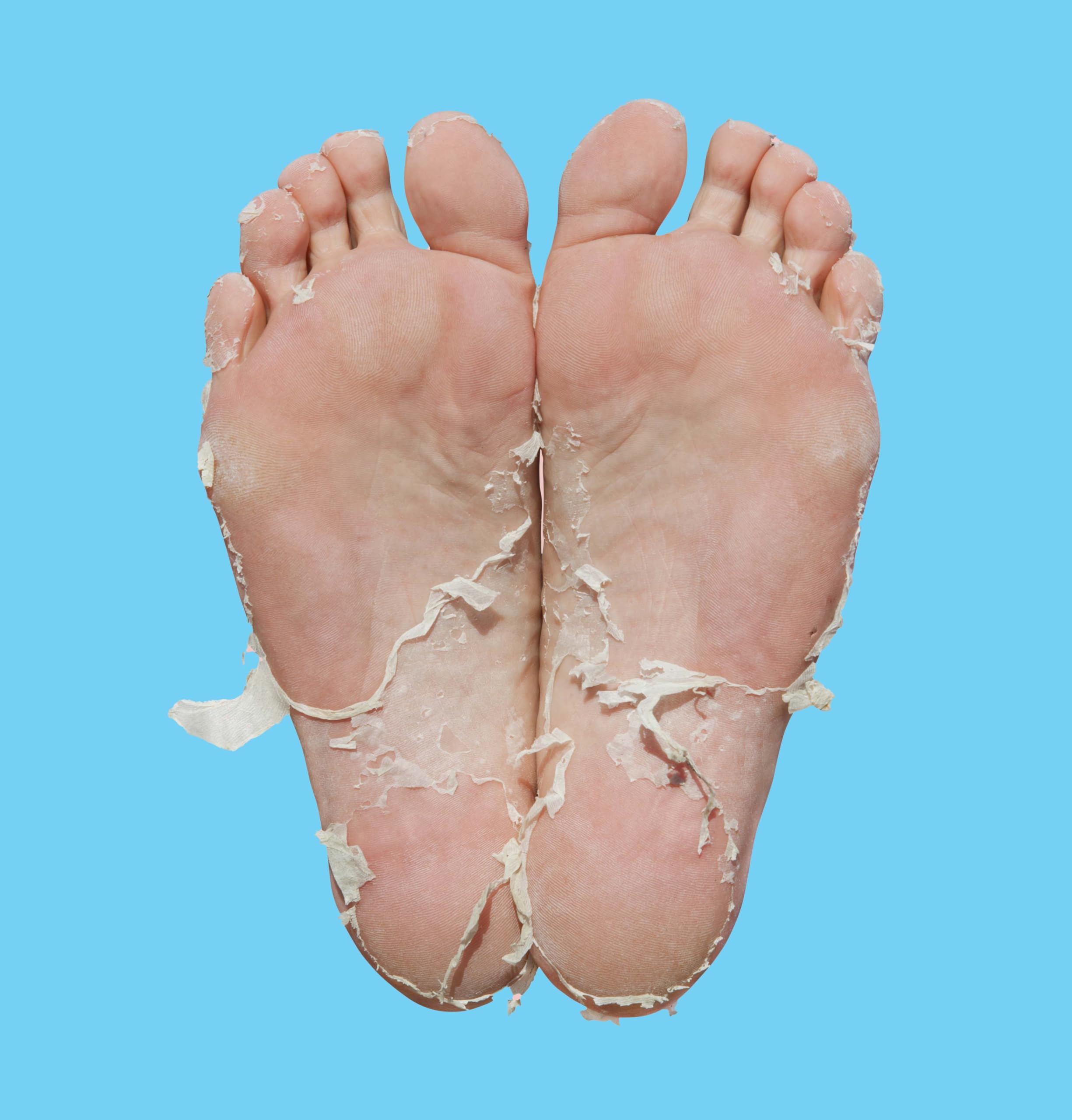 Skin Republic Pedi Foot Peel Max with 15% Stronger Acids for Cracked Heels & Odor 4