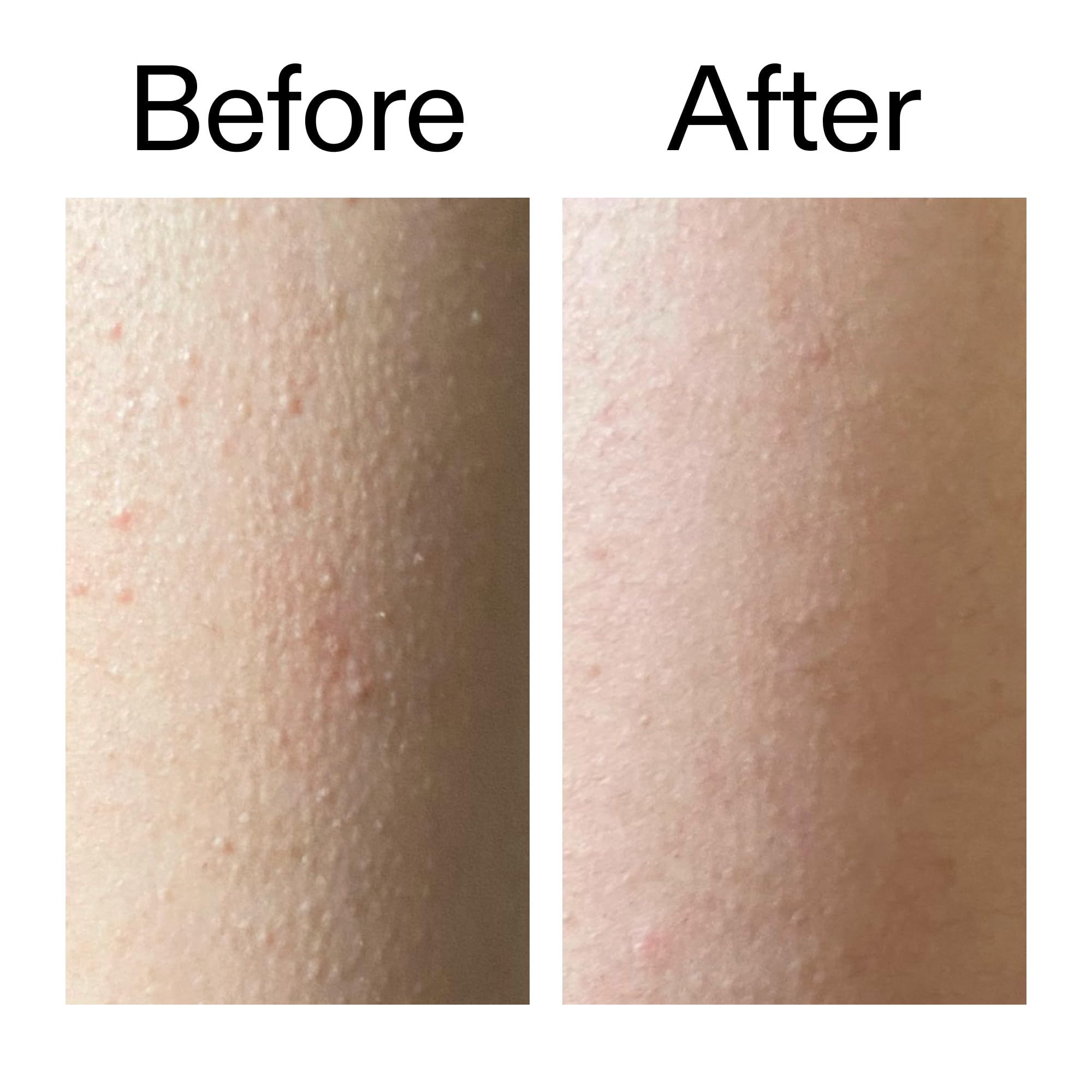 The INKEY List Glycolic Acid Exfoliating Body Stick for KP Bumps and Ingrown Hairs 45g 7