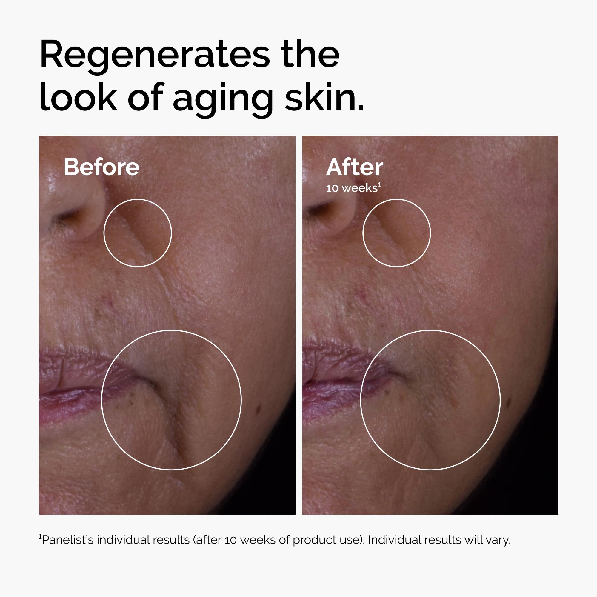 The Ordinary GF 15% Solution Anti-Aging Formula for Visible Skin & Wrinkle Improvement 4