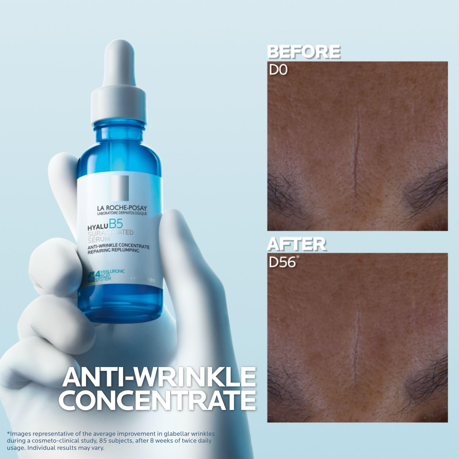 La Roche-Posay Hyalu B5 Hydrating Face Serum with Hyaluronic Acid for Dry Skin 6