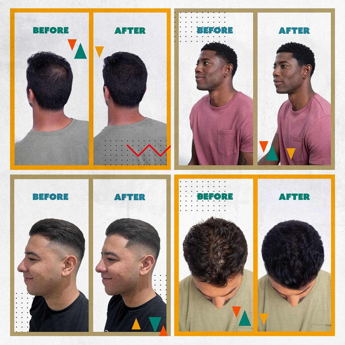 TOPPIK Hairline Optimiser for Natural Looking Hairline and Thicker Appearance 5