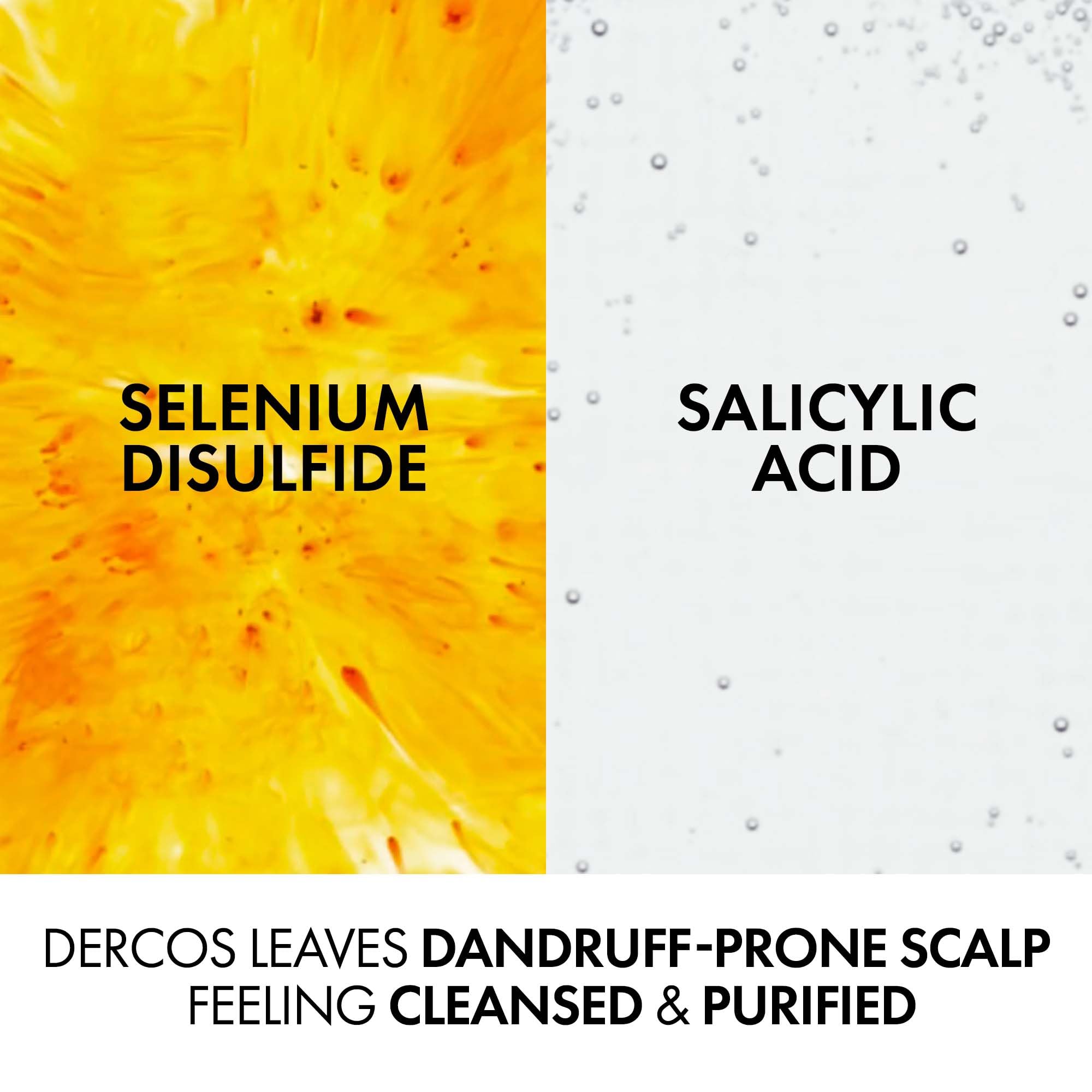 Vichy Dercos Anti-Schuppen- und Anti-Juckreiz-Shampoo für trockenes Haar und trockene Kopfhaut 390 5