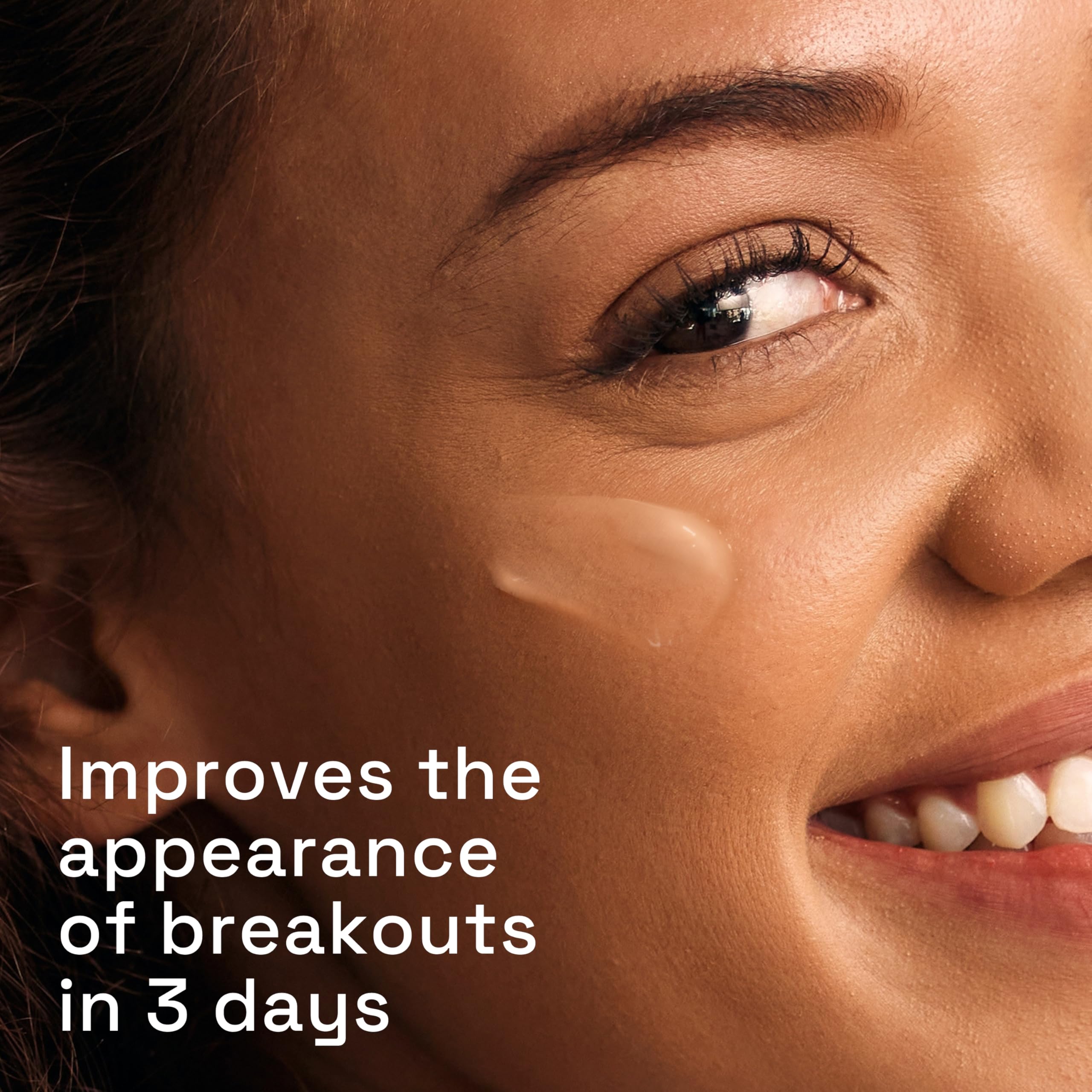 Cetaphil Gentle Clear Triple-Action Blemish Serum 30ml with 0.5% Salicylic Acid 3