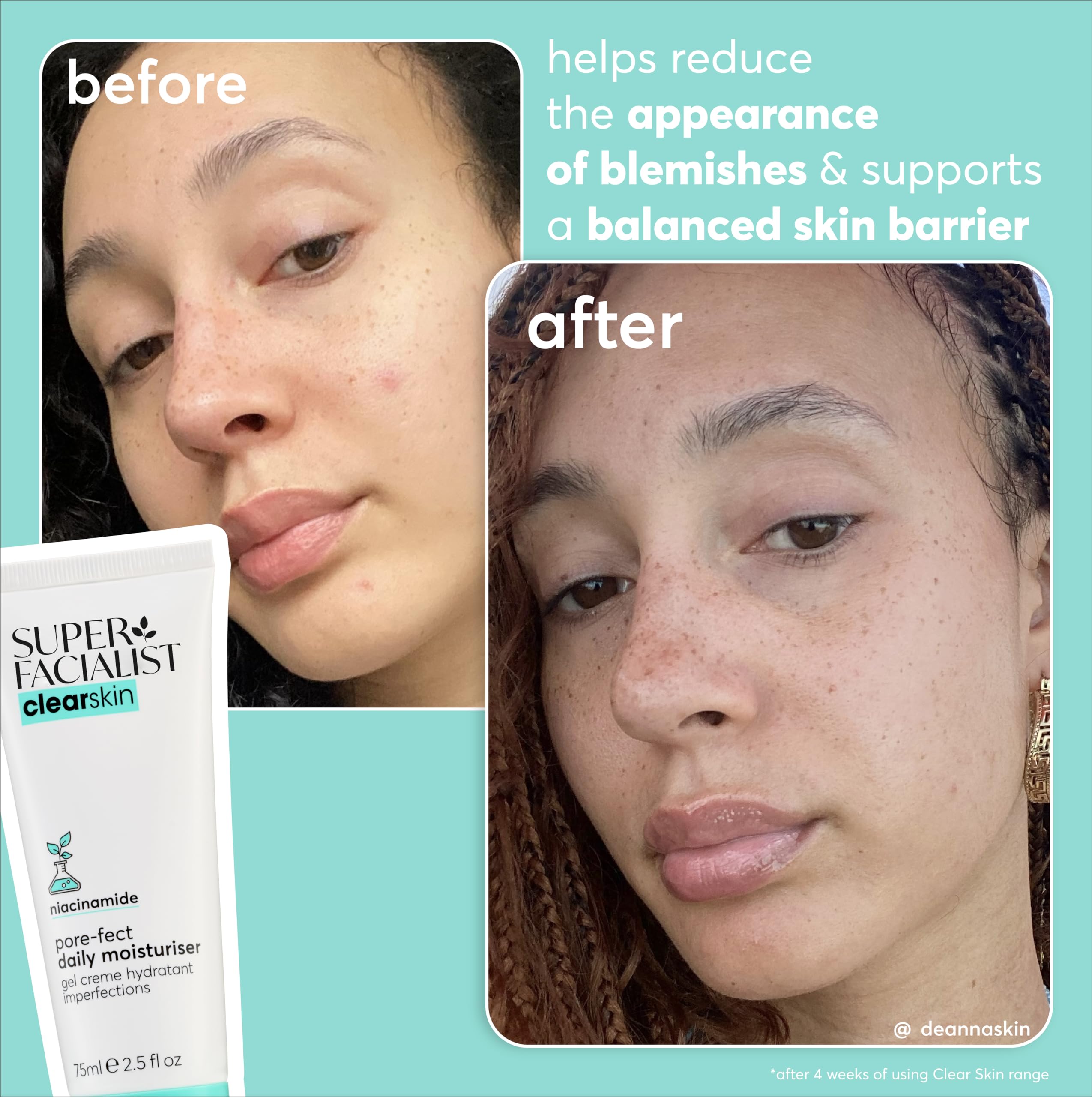 Super Facialist Clear Skin Pore Clarity Daily Exfoliator 150ml with Niacinamide & Tea Tree Oil 3