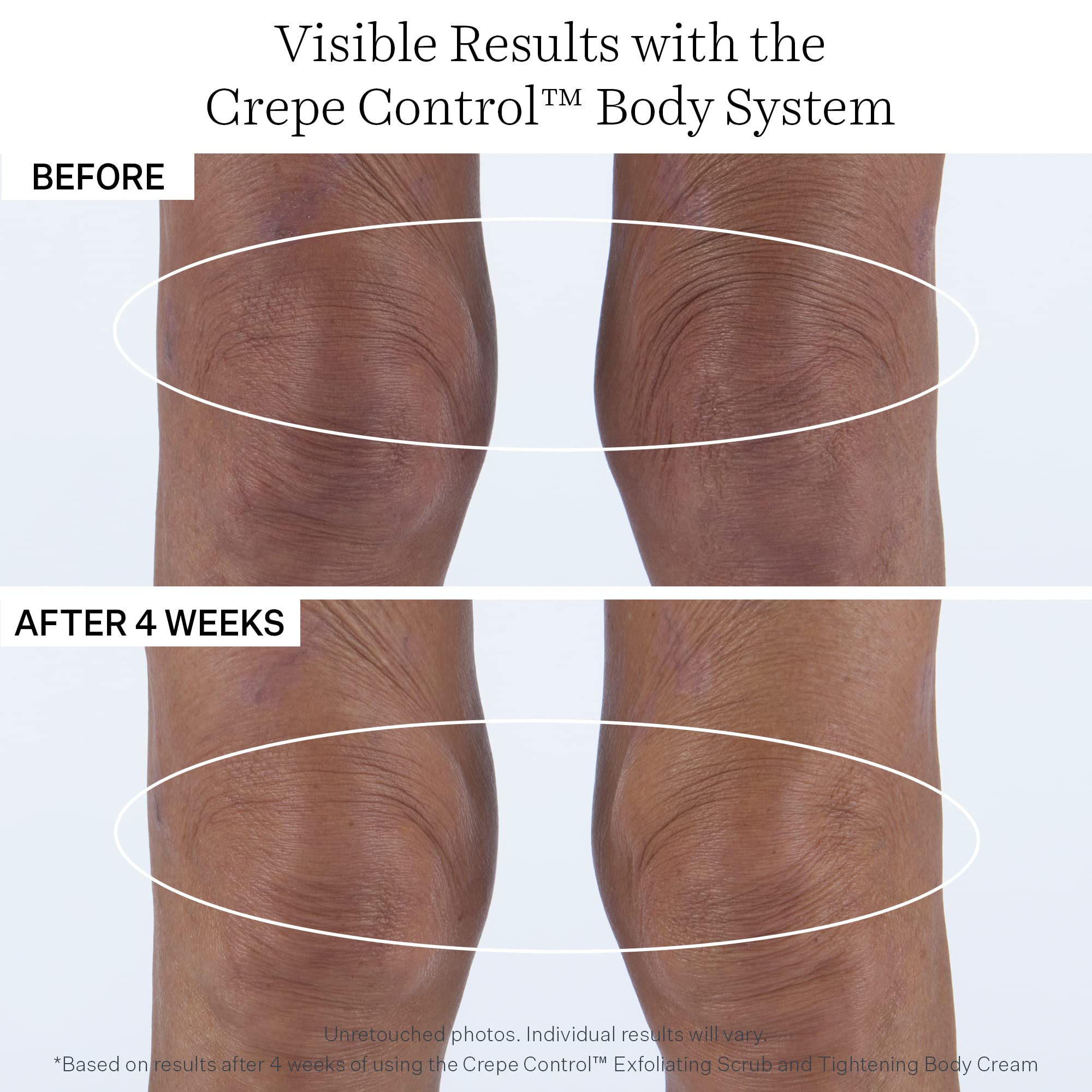 StriVectin Tighten & Lift Crepe Control Body Cream with Tightening Peptides (200ml) 9